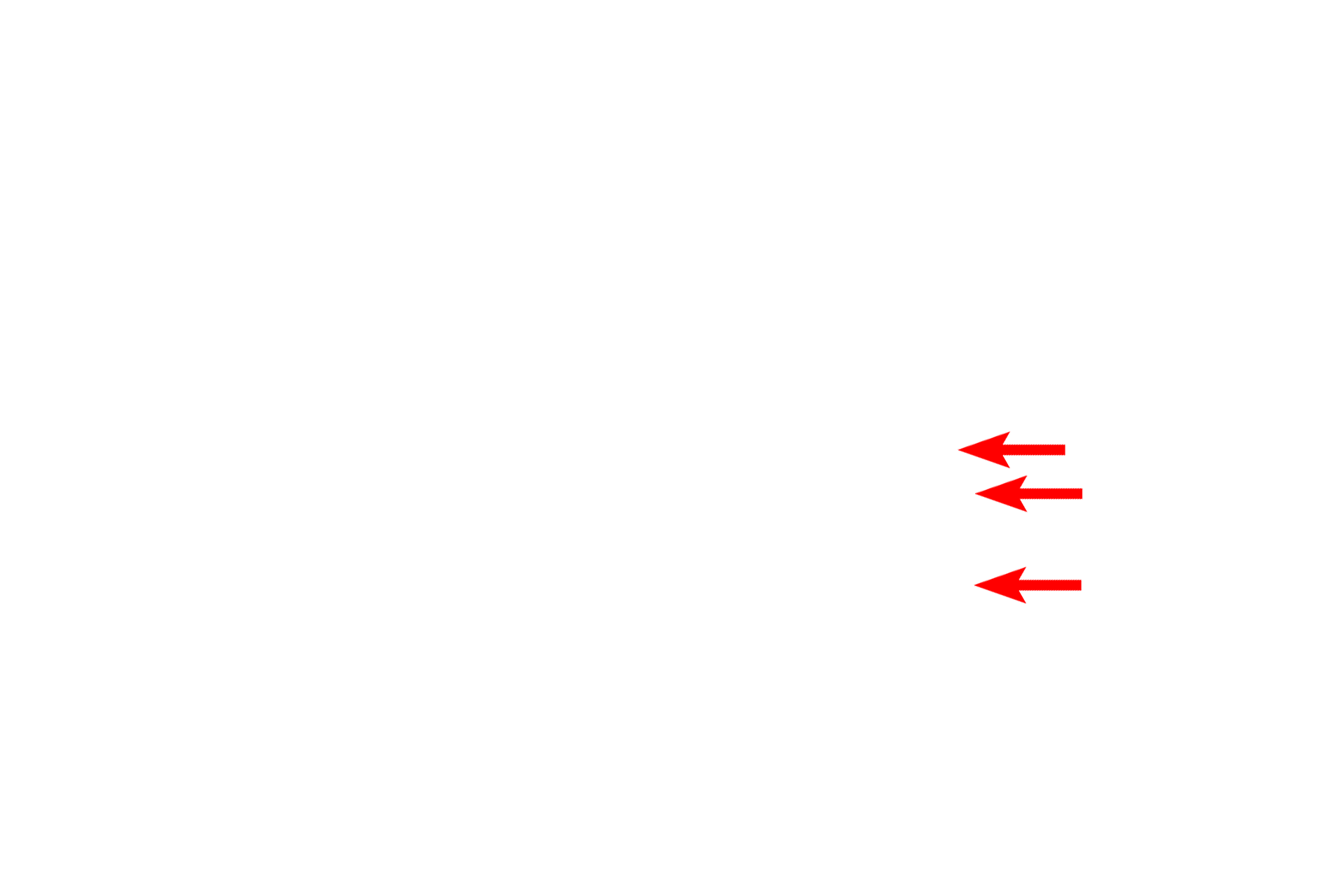 Cytoplasm <p>In actively secreting cells, the RER is very extensive and consists of large numbers of interconnecting, flattened sacs or cisterns.  Also visible in this field is the nuclear envelope showing ribosomes on the cytoplasmic surface of the outer nuclear membrane.  Mitochondria and lipid droplets are also present.  40,000x</p>
