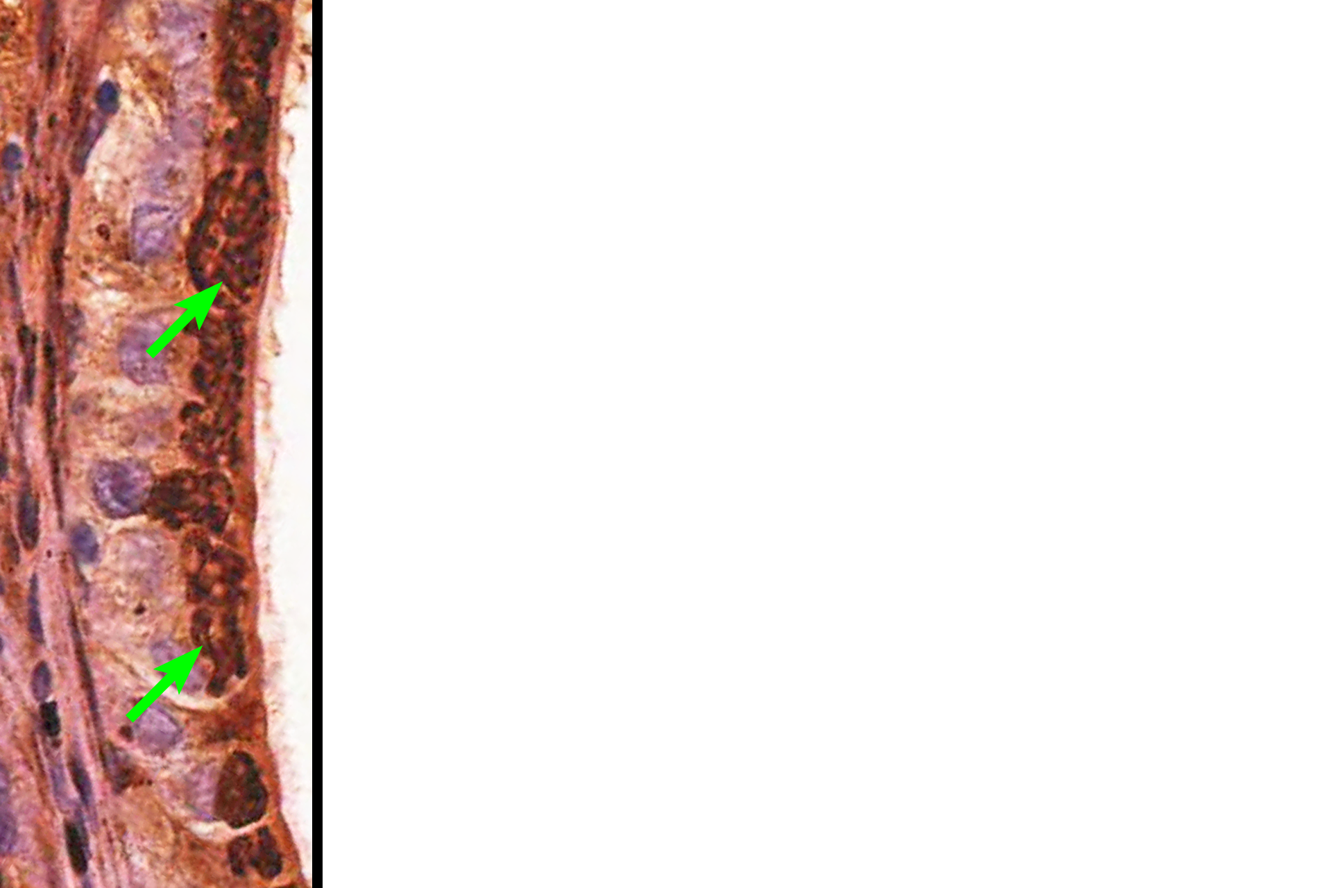 Golgi apparatus (silver) > <p>This image shows a row of epithelium cells in which the Golgi apparatus has been stained by the silver method which does label the Golgi membranes.  Here the Golgi can been seen as a threadlike network in the apical region of the cells.  Conventional staining methods do not reveal these membranes.</p>
