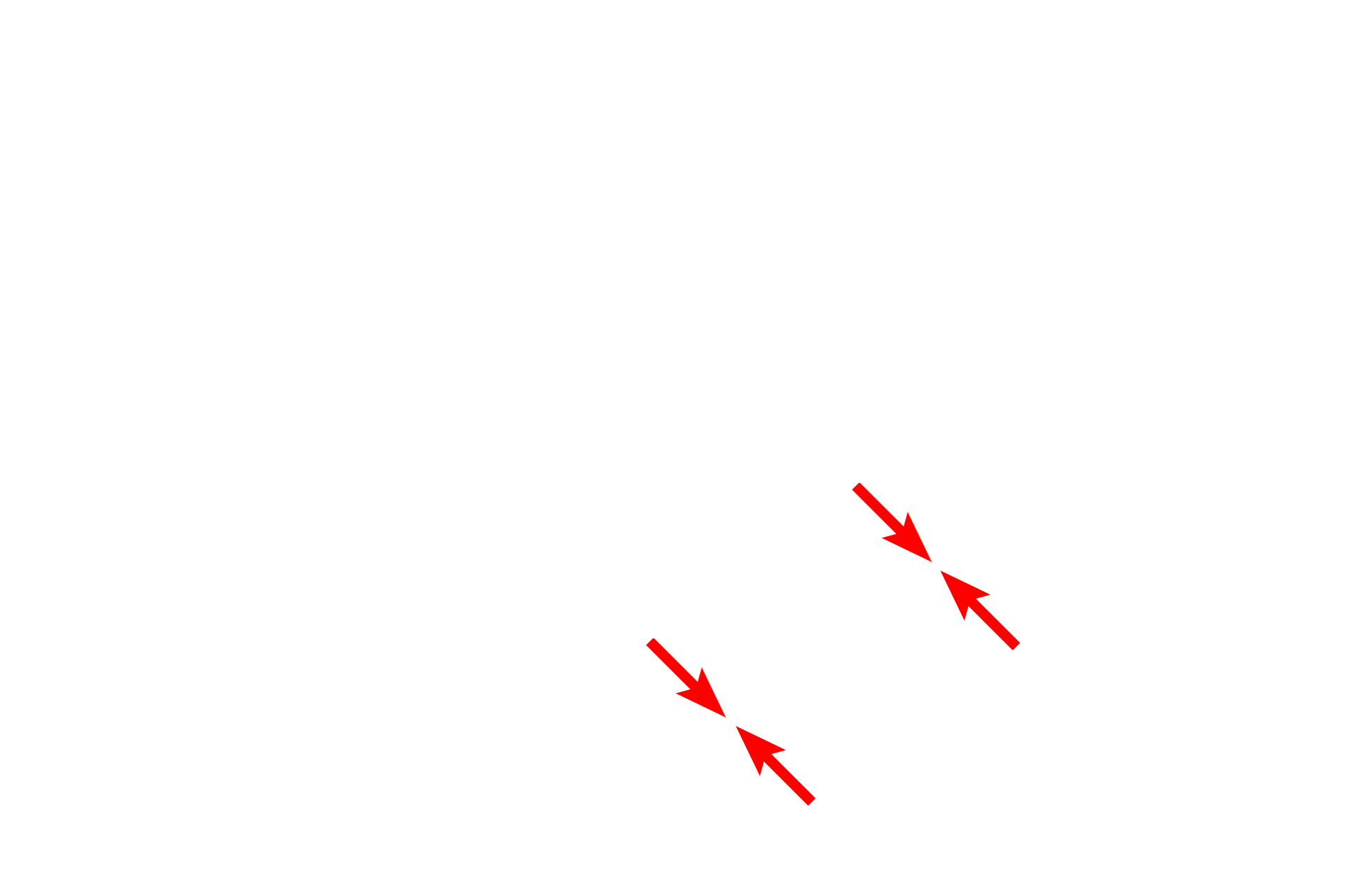  - Nuclear envelope <p>Three regions of the nucleolus are visible in this electron micrograph.  The pale areas are the nucleolar organizing centers.  The most dense areas are the pars fibrosa, which contain newly synthesized primary transcripts of RNA genes.  The pars granulosa has a granular appearance and contains maturing ribosomal particles.  30,000x</p>
