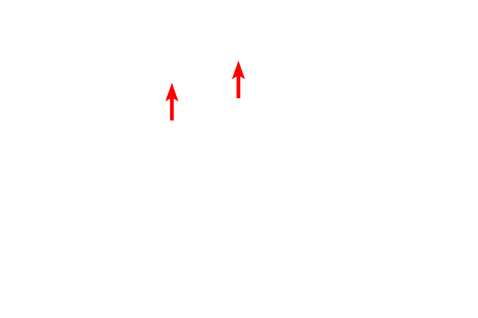 Mitochrondria <p>The nucleus of this cell demonstrates a large amount of heterochromatin which is mostly peripherally distributed.  In some cases the pattern of heterochromatin can be used to identify cells, such as in this plasma cell.  8000x</p>
