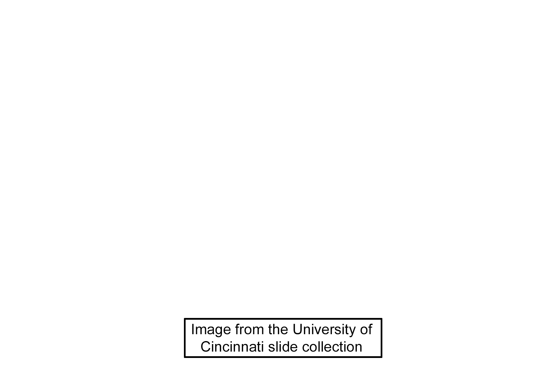 Image source > <p>Image source > Image from the University of Cincinnati slide collection.</p>
