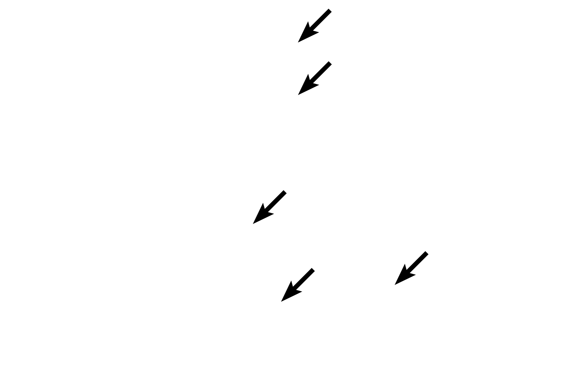Woven bone > <p>Areas of woven bone are still present in the center of this image, displaying a more amorphous structure. The osteocytes are rounder compared to lamellar bone.</p>
