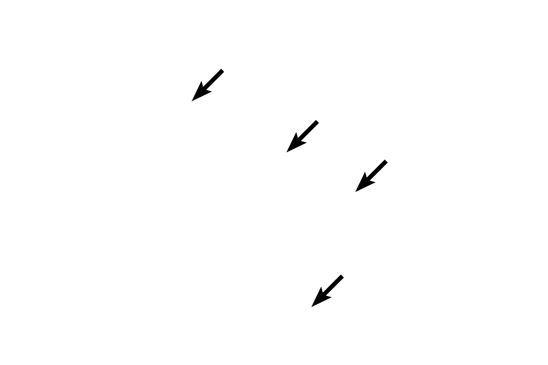  - Haversian canals <p>Concentrically arranged lamellae form osteons in the central region of the bone. Bone surfaces are covered or lined by flattened lamellae that are arranged circumferentially. In lamellar bone, osteocytes are more flattened, located between lamellae.</p>
