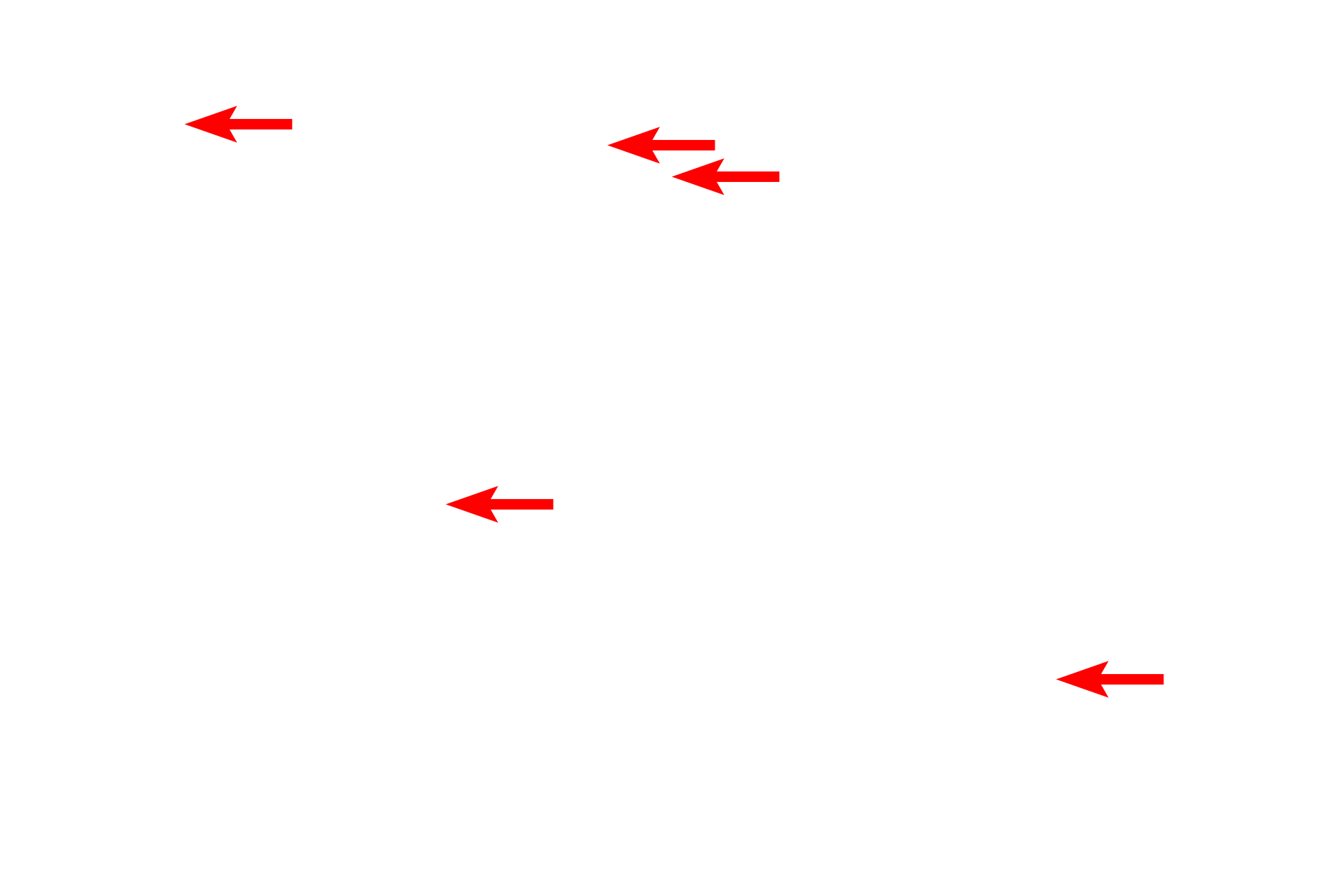  - Lamellae <p>This ground bone preparation of mature, lamellar bone shows additional passageways in the matrix, called Volkmann’s canals, which are oriented perpendicularly to the long axis of the osteon.  Volkmann’s canals interconnect Haversian canals of adjacent osteons, conveying branches from blood vessels traveling in the Haversian canal. This extensive system of passageways is necessary as the calcified matrix prevents diffusion of nutrients and respiratory gasses. Both Volkmann’s and Haversian canals contain blood vessels and are lined by endosteum. 400x</p>
