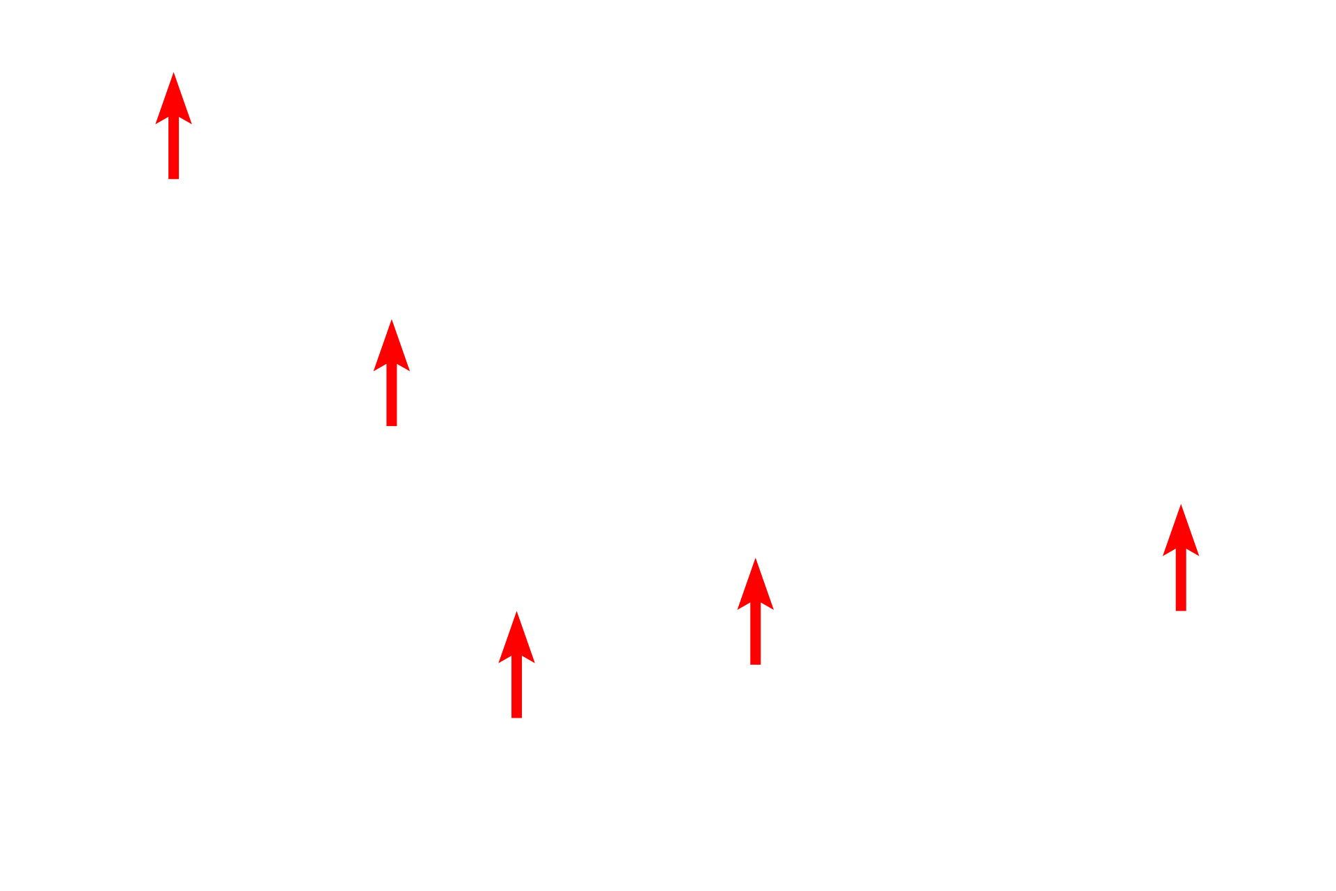  - Haversian canals <p>This ground bone preparation of mature, lamellar bone shows additional passageways in the matrix, called Volkmann’s canals, which are oriented perpendicularly to the long axis of the osteon.  Volkmann’s canals interconnect Haversian canals of adjacent osteons, conveying branches from blood vessels traveling in the Haversian canal. This extensive system of passageways is necessary as the calcified matrix prevents diffusion of nutrients and respiratory gasses. Both Volkmann’s and Haversian canals contain blood vessels and are lined by endosteum. 400x</p>
