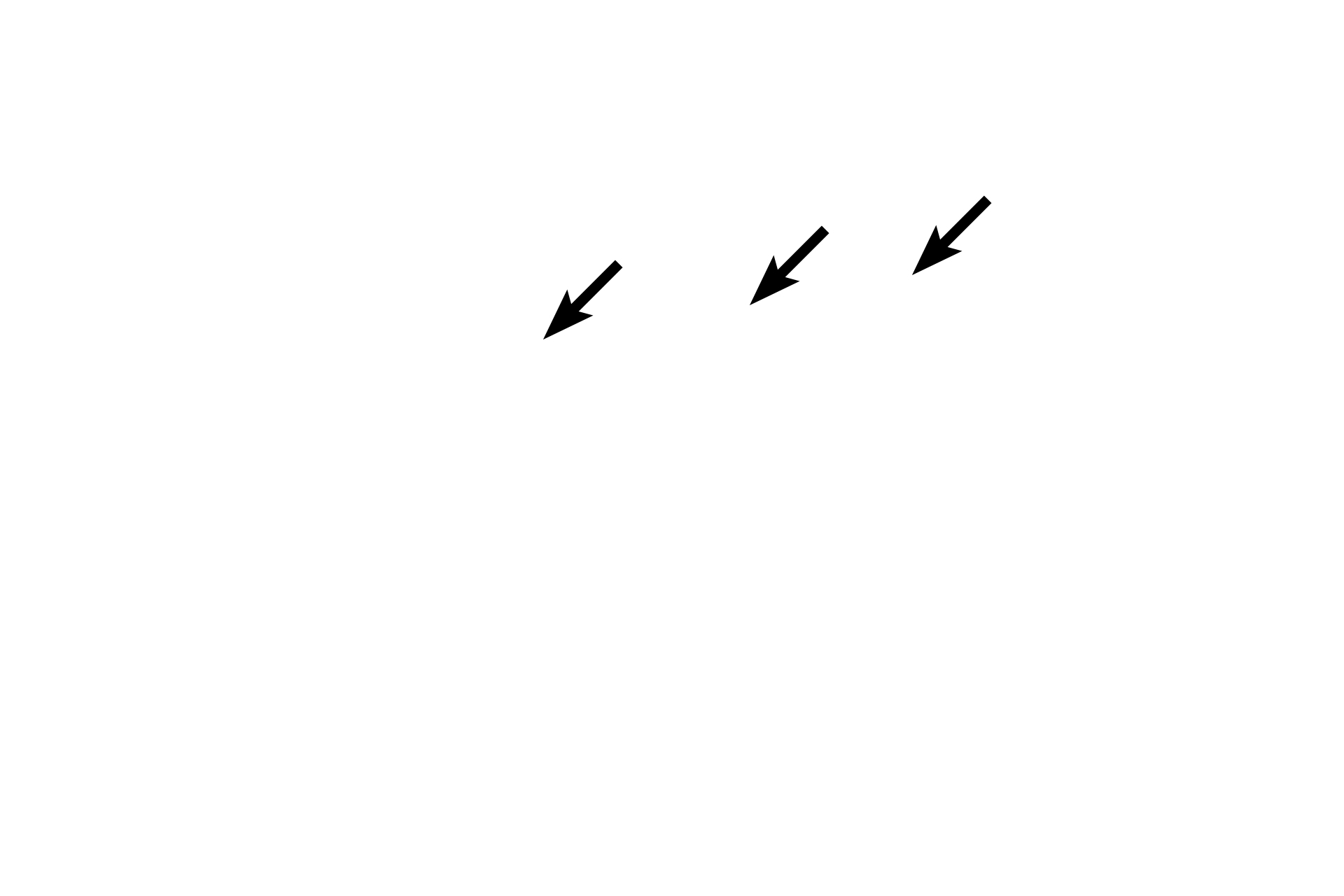  - Osteoid <p>All four bone cells are seen in this image. Osteoblasts, osteocytes and bone-lining cells lie on the surface of bone and are part of the endosteum and periosteum. Osteocytes lie internally, completely surrounded by bony matrix. Developing bone, 200x</p>
