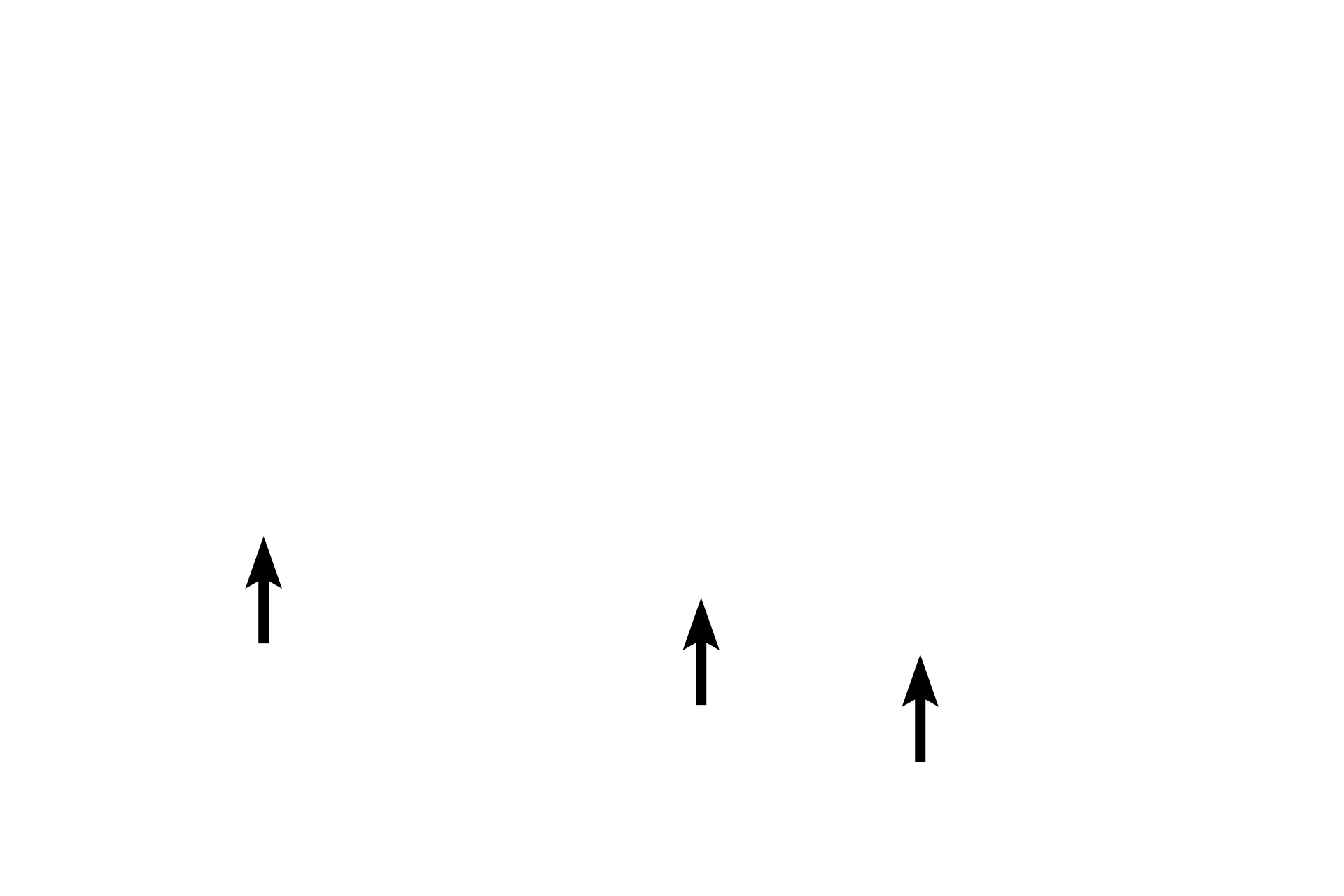 Bone lining cells <p>All four bone cells are seen in this image. Osteoblasts, osteocytes and bone-lining cells lie on the surface of bone and are part of the endosteum and periosteum. Osteocytes lie internally, completely surrounded by bony matrix. Developing bone, 200x</p>
