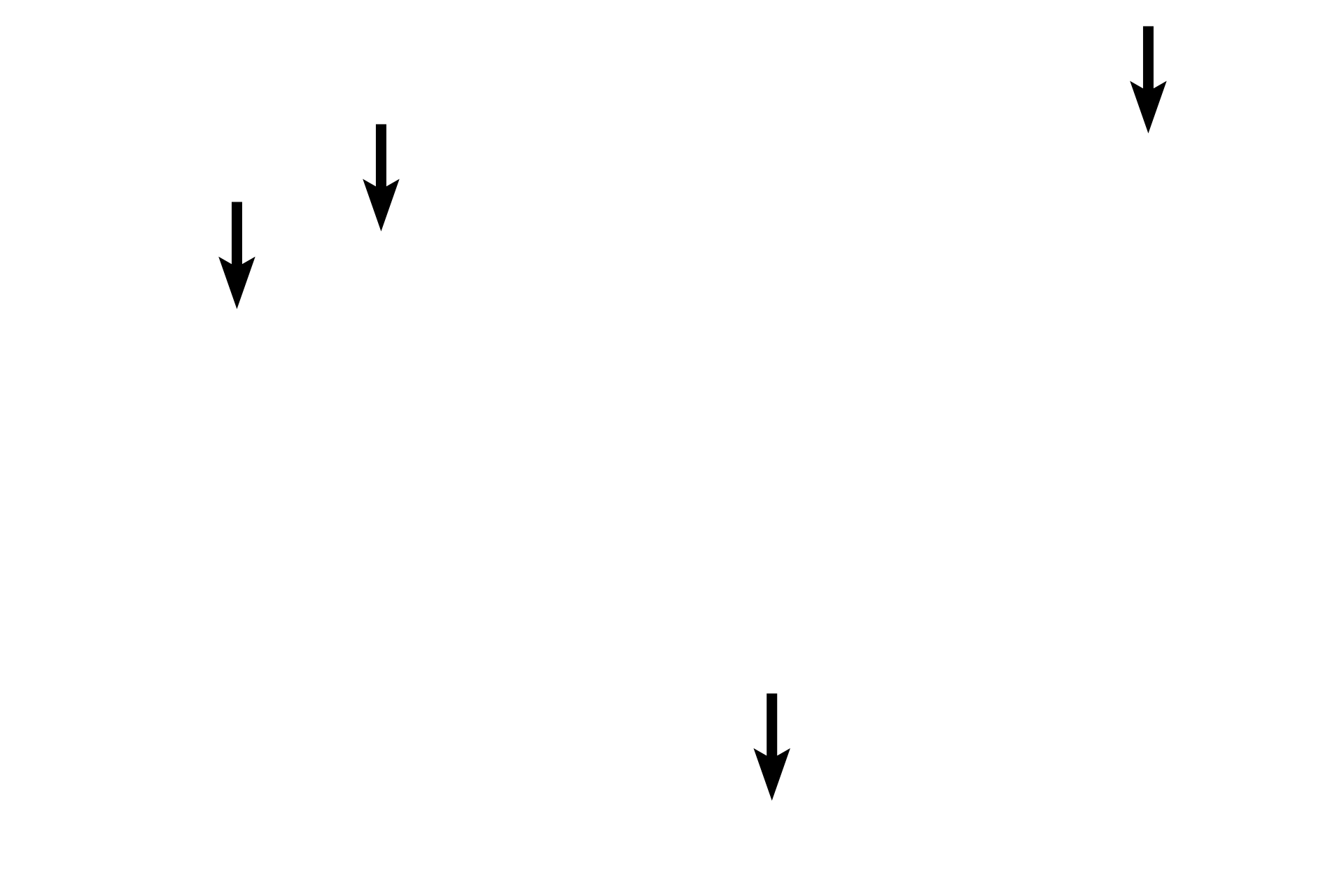 Osteocytes <p>All four bone cells are seen in this image. Osteoblasts, osteocytes and bone-lining cells lie on the surface of bone and are part of the endosteum and periosteum. Osteocytes lie internally, completely surrounded by bony matrix. Developing bone, 200x</p>
