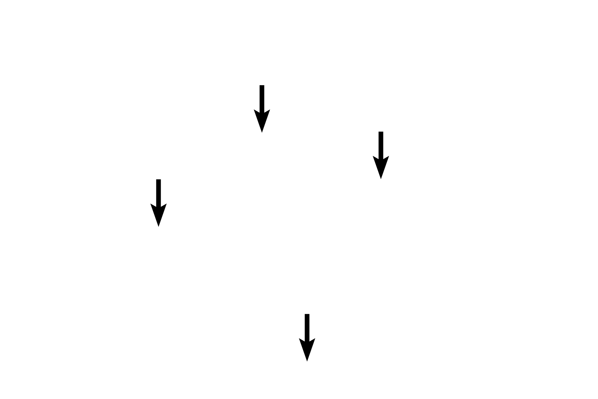  - Chondrocytes <p>Collagen fibers continue uninterrupted into and through the fibrocartilage. The chondrocytes in their lacunae are spherical, surrounded by the firm, rubbery ground substance. The ground substance stains pale blue.</p>
