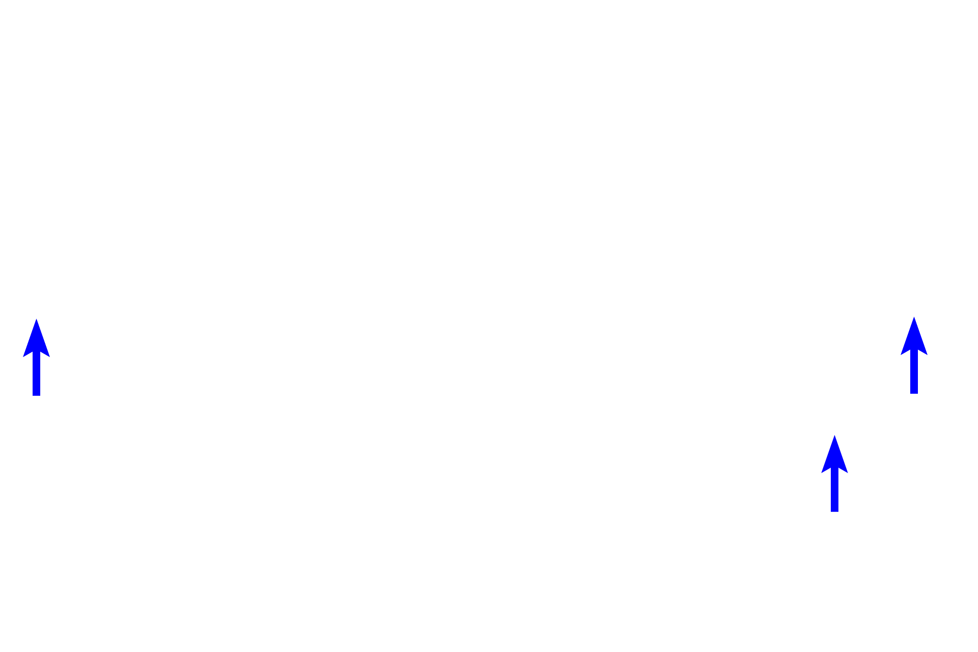 Connective tissue proper <p>As are all spaces in the body, the lumen of the trachea is lined by an epithelium that forms a distinct border facing the lumen. Loose connective tissue containing glands underlies the epithelium.</p>
