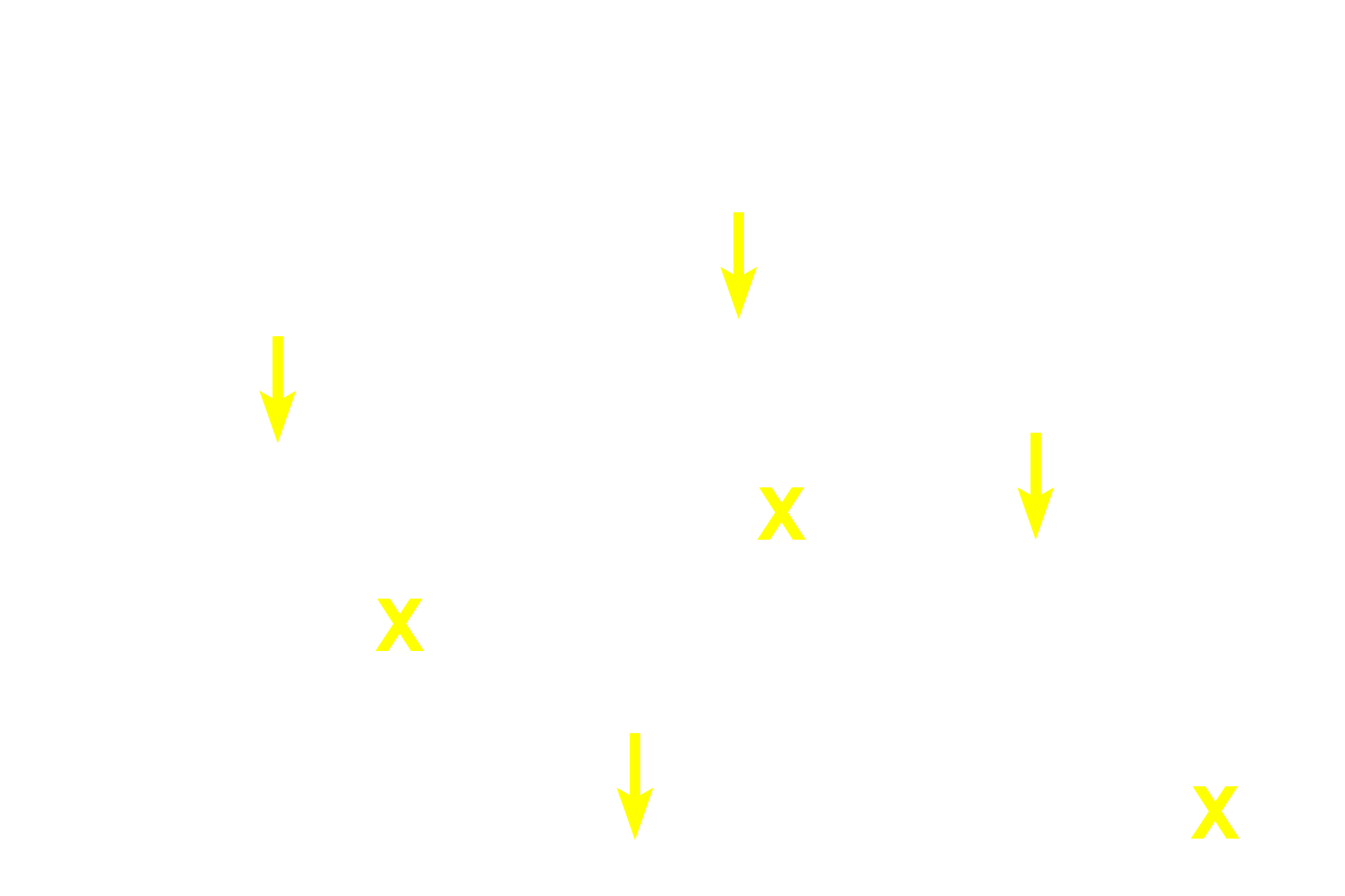 Extracellular matrix > <p>Extracellular matrix is secreted by each chondrocyte and accounts for a majority of the mass of hyaline cartilage. It consists of both Type II collagen fibers and glycosaminoglycans resulting in a rigid but deformable mass. No blood vessels are present, so nutrients must diffuse through the matrix to supply the chondrocytes.</p>
