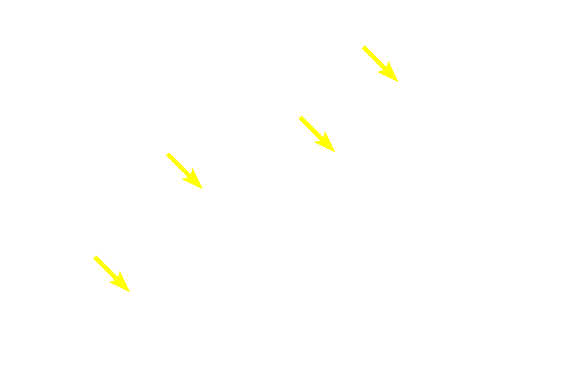 Territorial matrix <p>Isogenous groups and interstitial growth results when chondrocytes divide and produce extracellular matrix. Territorial matrix lies immediately around each isogenous group and is high in glycosaminoglycans. Therefore, this matrix stains more intensely than matrix farther from an isogenous group, the interterritorial matrix. Collagen fibrils are not visible in hyaline cartilage matrix. 1000x</p>
