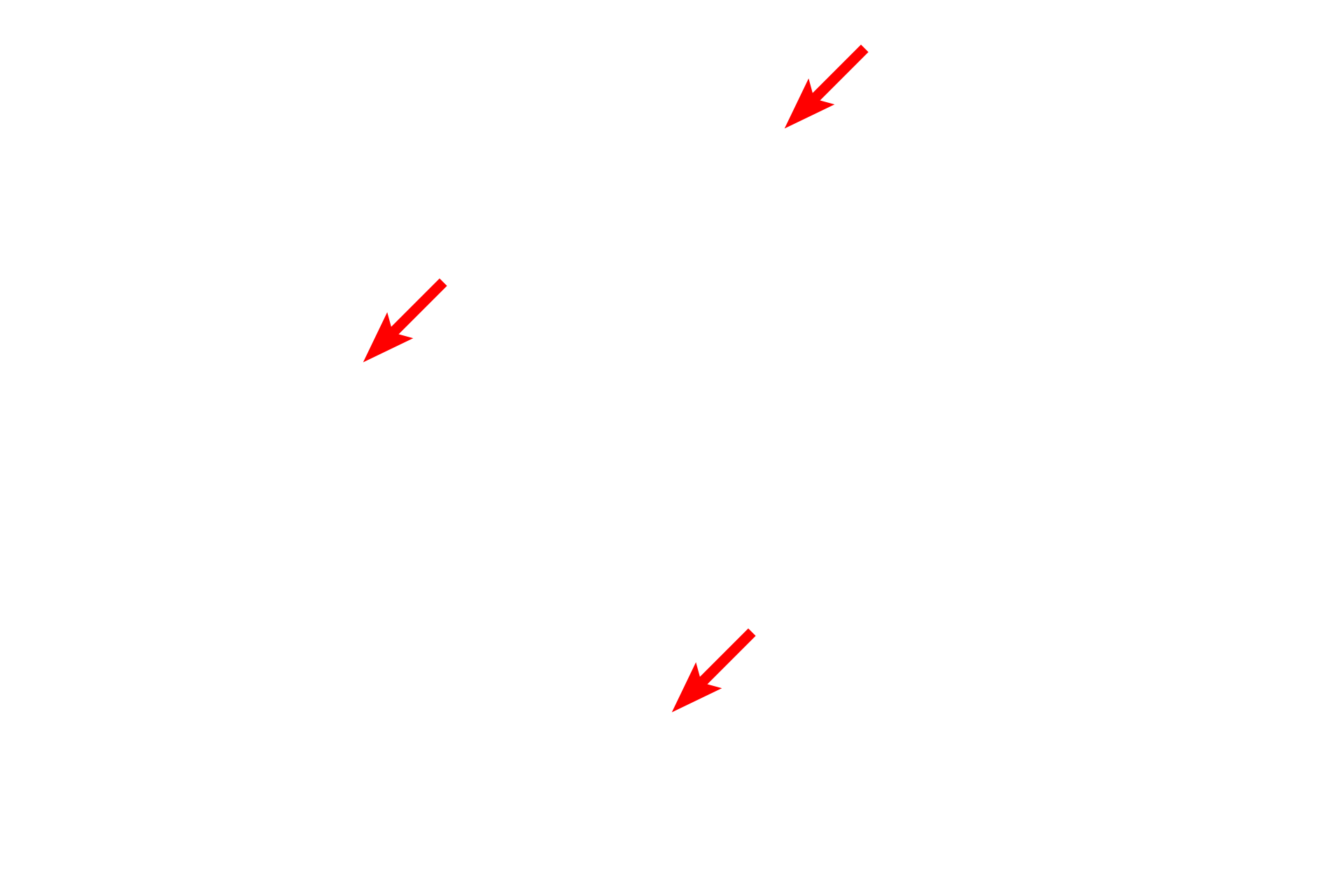 Chondrocytes <p>Chondrocytes lie in potential spaces in cartilage called lacunae. Shrinkage of chondrocytes during tissue preparation creates the impression of a true space surrounding these cells. In life, this space is filled with matrix. Nutrients must diffuse through the cartilage matrix to reach the chondrocytes, so chondrocytes store glycogen and lipid as energy sources. Toluidine blue stain 1000x</p>
