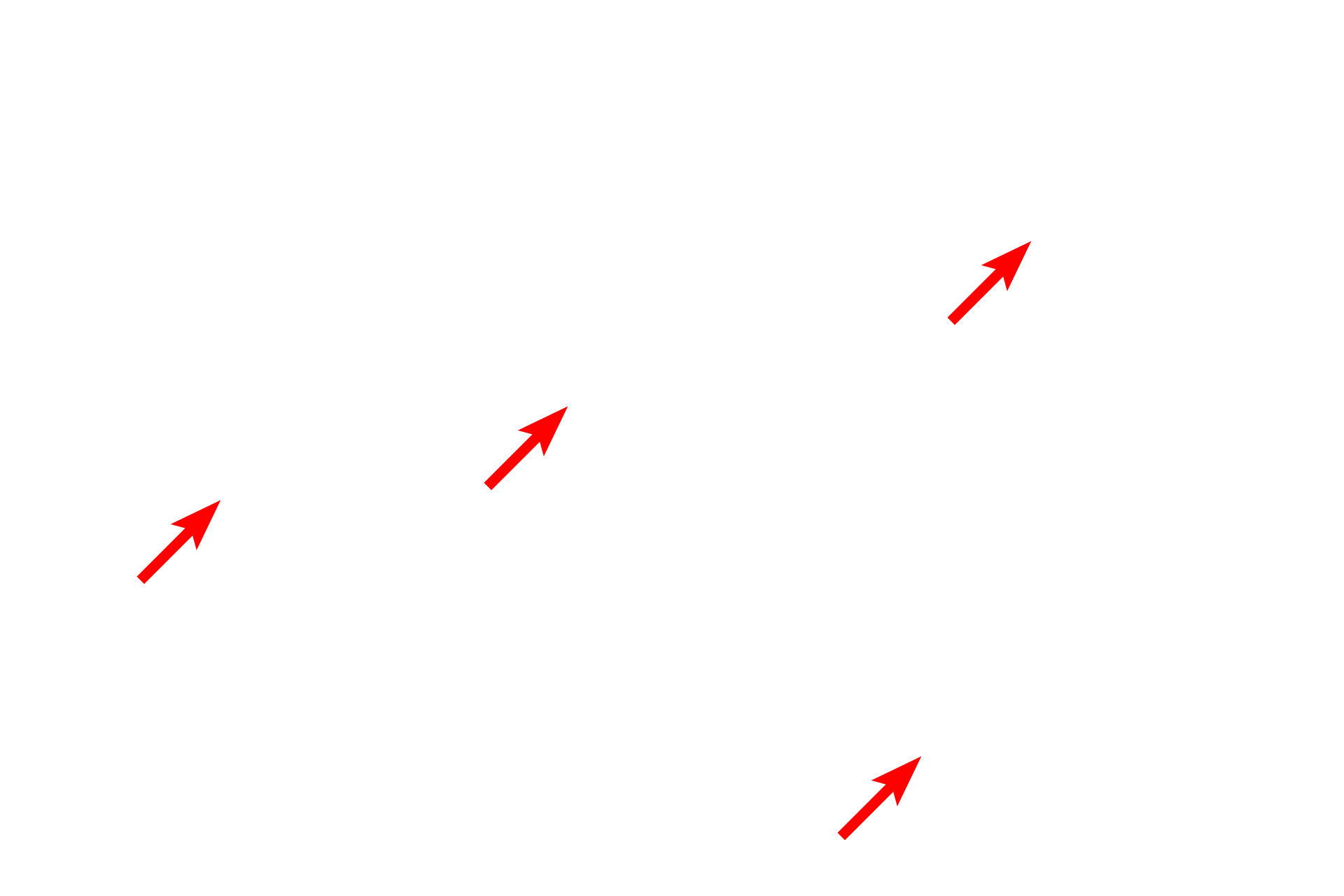 Lacunae <p>Chondrocytes lie in potential spaces in cartilage called lacunae. Shrinkage of chondrocytes during tissue preparation creates the impression of a true space surrounding these cells. In life, this space is filled with matrix. Nutrients must diffuse through the cartilage matrix to reach the chondrocytes, so chondrocytes store glycogen and lipid as energy sources. Toluidine blue stain 1000x</p>

