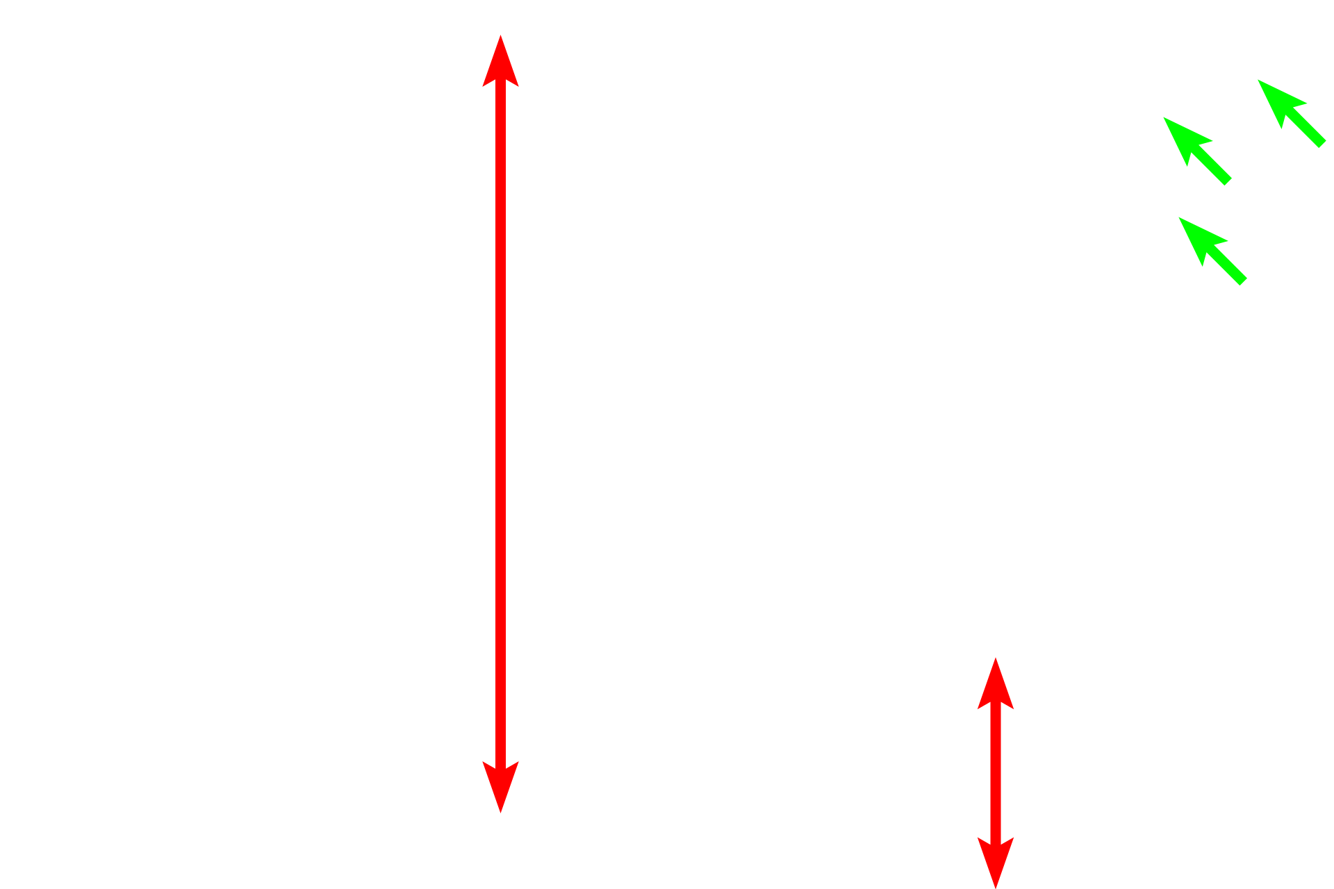 Chondrocytes <p>This electron micrograph shows chondrocytes surrounded by matrix. The accompanying light micrograph inset shows a similar area. 12,000x, 1000x (inset).</p>
