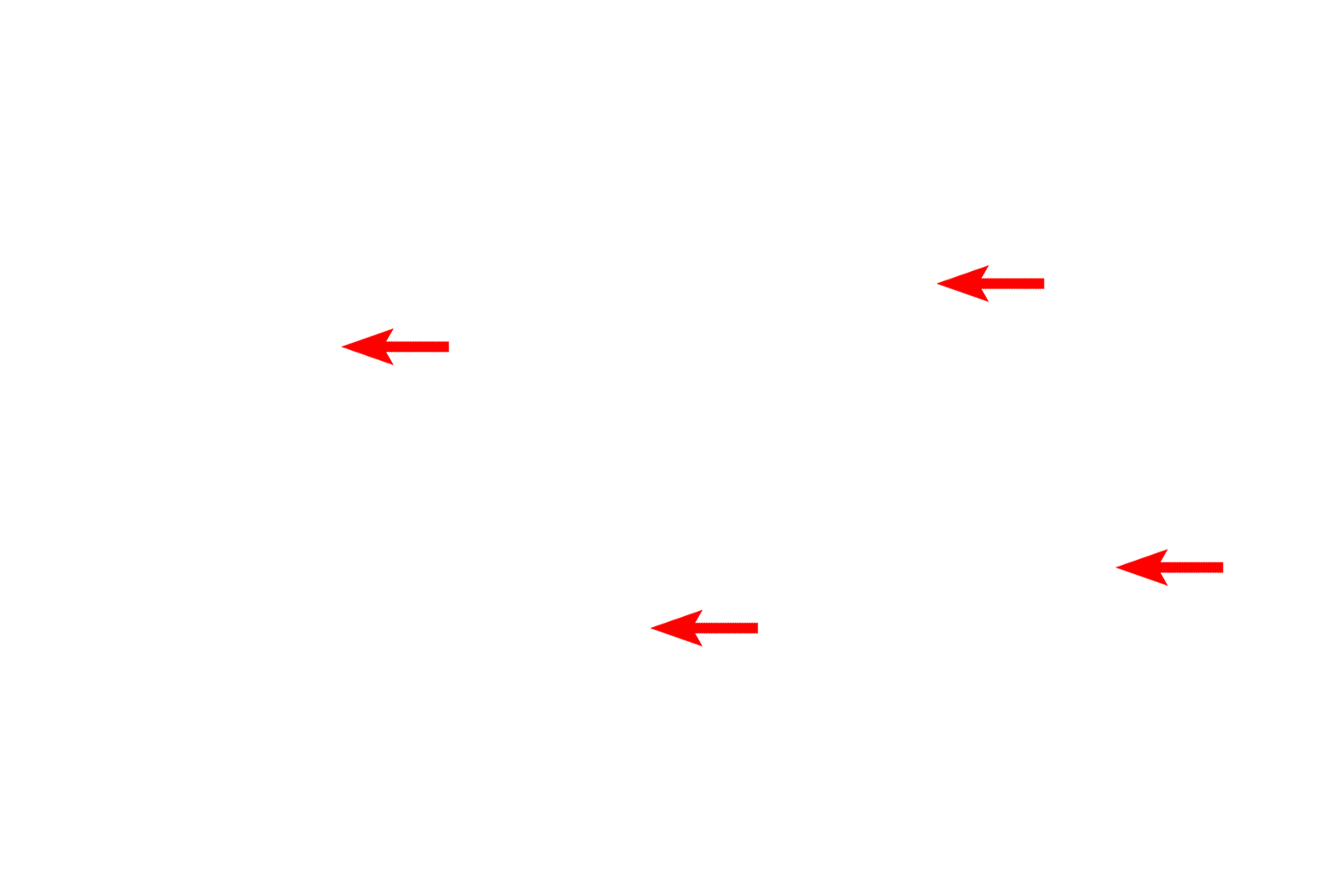 Reticular fibers <p>Reticular fibers are composed of Type III collagen and require special stains to be clearly identified.  Reticular fibers stain with silver (seen here) as well as PAS since they are glycosylated.  Reticular fibers are quite thin and they branch, forming a meshwork that provides the stroma for lymphatic organs (except thymus), endocrine organs and liver.  They also surround muscle cells, adipocytes, nerves and blood vessels. Lymph node 400x</p>
