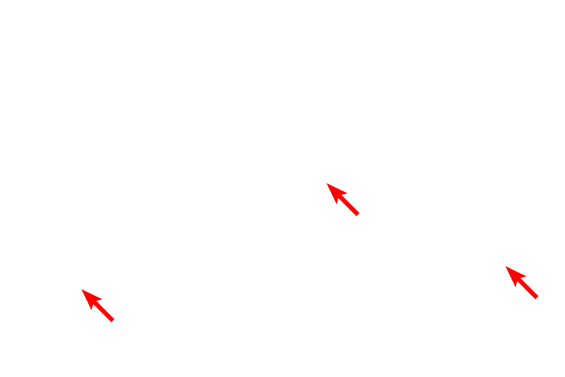 Blood vessels <p>Reticular fibers are a component of all connective tissues proper and provide the sole stroma for lymphatic organs (except thymus) and hemopoietic tissue. Reticular fibers also surround adipocytes, small blood vessels and nerves, and muscle fibers. This high magnification image illustrates the characteristic branching meshwork of reticular fibers. Lymph node 1000x</p>

