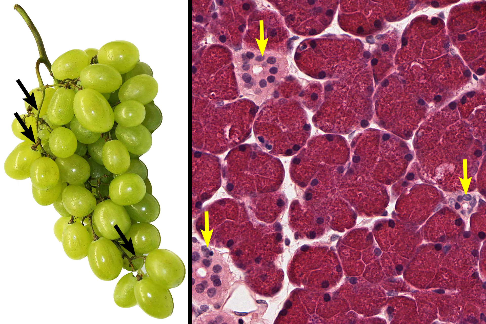  - Intralobular ducts <p>The structure of a compound acinar gland is analogous to the organization of a bunch of grapes.  Each bunch represents a lobule with individual grapes corresponding to acini.  Smaller stems connecting to the grapes denote intralobular ducts with the larger stems representing the interlobular duct.  It’s helpful to keep this similarity in mind when interpreting tissue sections of compound glands.</p>
