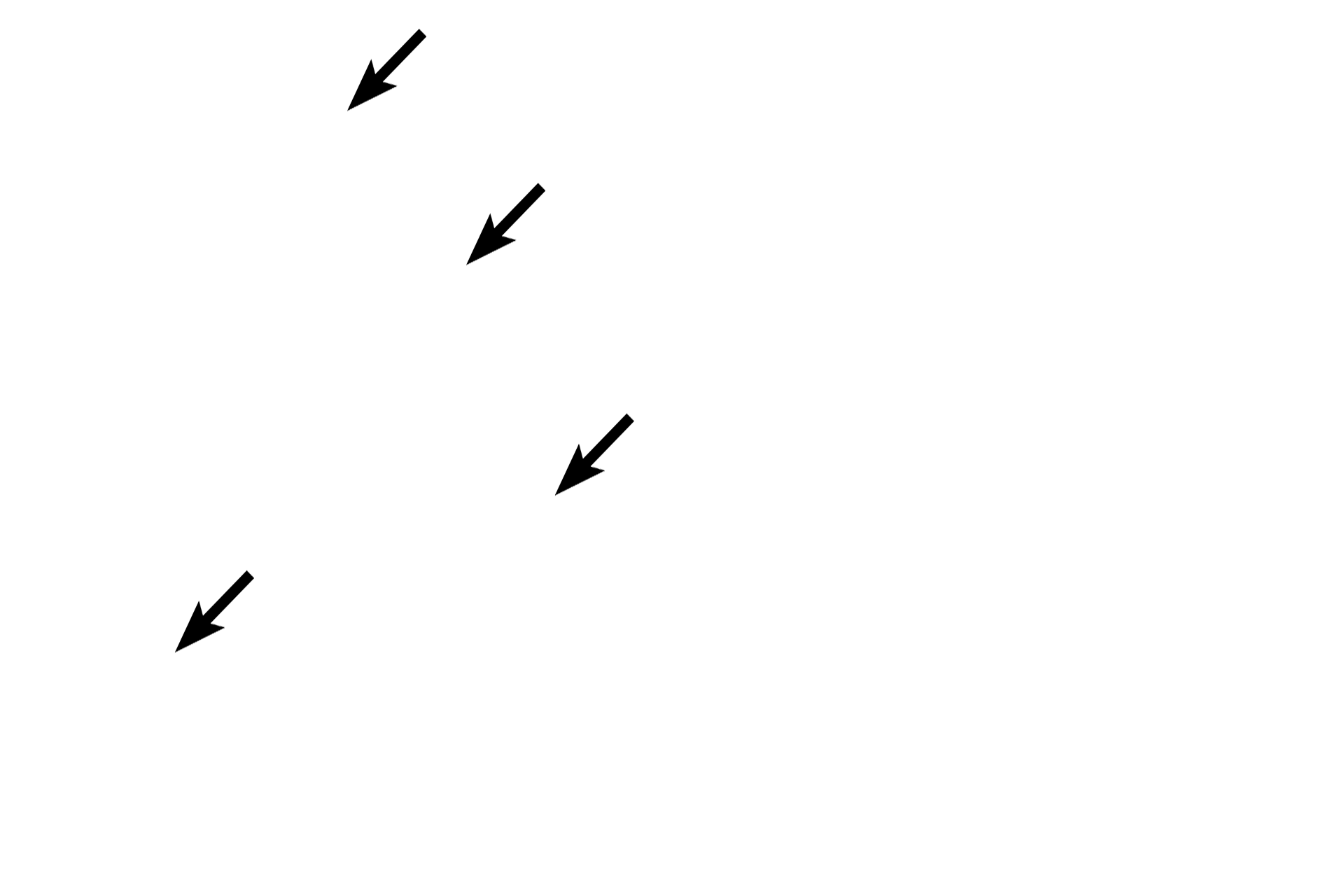  - RER <p>An acinus resembles a grapefruit cut in half, with each grapefruit segment representing an individual cell.  The RER and nucleus are basally located in the cells, while their secretory granules are present in the apical regions.  At the center of the acinus is a narrow lumen.  Acinar secretions are watery or serous which enter the small central lumen.</p>
