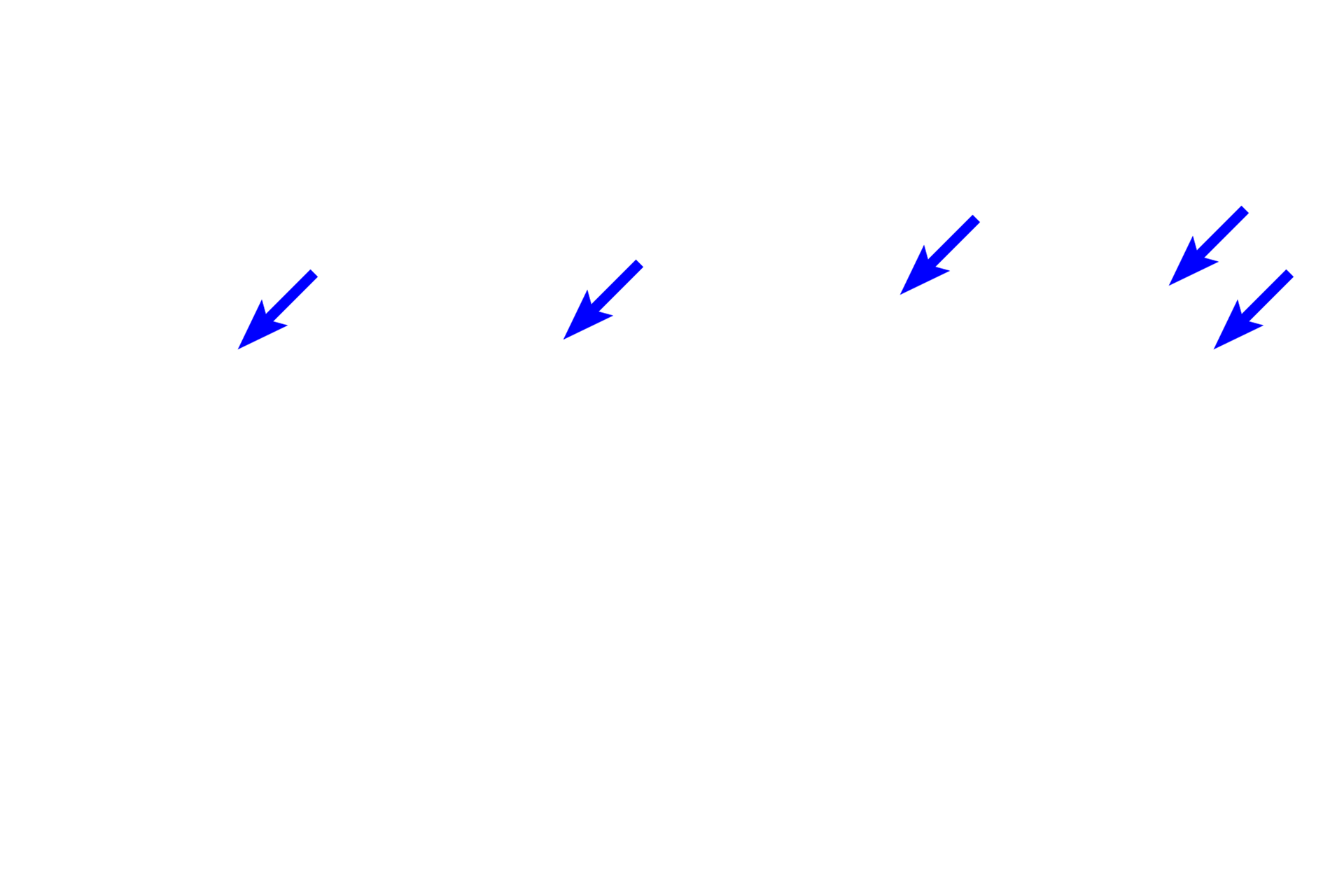 Nuclear shapes > <p>The shape of the nucleus is a good indicator of the overall shape of the cell.  In squamous cells, the nucleus is flat, in cuboidal cells the nucleus is spherical, and in columnar cells the nucleus is oval.  These features are helpful in studying tissue sections where cell outlines are not always readily visible.</p>
