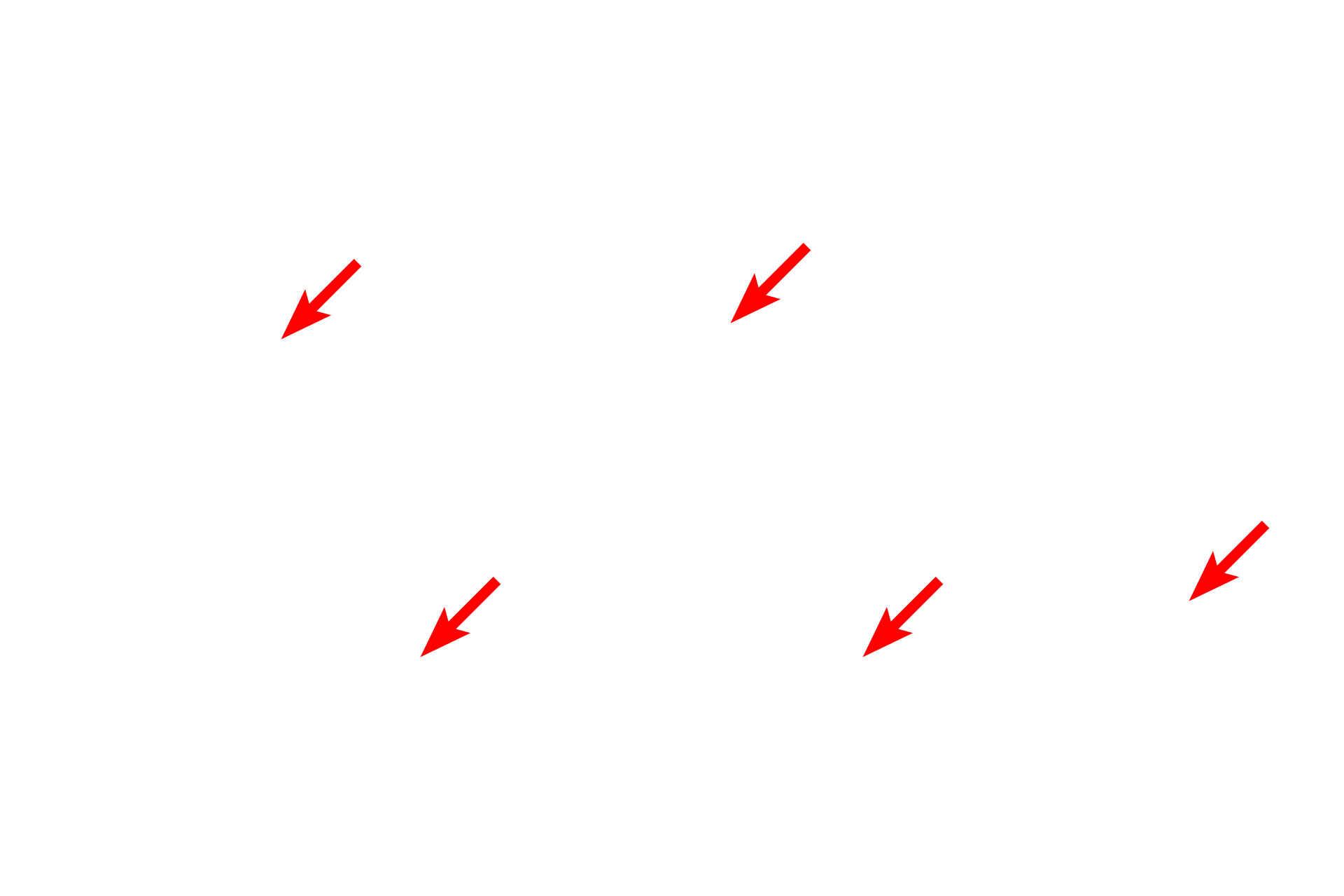  - Myofibrils <p>This low magnification electron micrograph shows a portion of two skeletal muscle fibers. The cytoplasm of the fibers is completely filled with myofibrils. A peripheral nucleus in the one of fibers is also visible. Located between the myofibrils are mitochondria and elements of the endoplasmic reticulum. 5000x</p>
