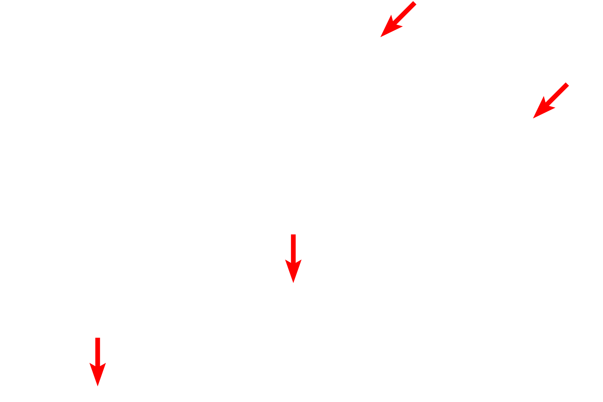  - Sarcolemma <p>This low magnification electron micrograph shows a portion of two skeletal muscle fibers. The cytoplasm of the fibers is completely filled with myofibrils. A peripheral nucleus in the one of fibers is also visible. Located between the myofibrils are mitochondria and elements of the endoplasmic reticulum. 5000x</p>

