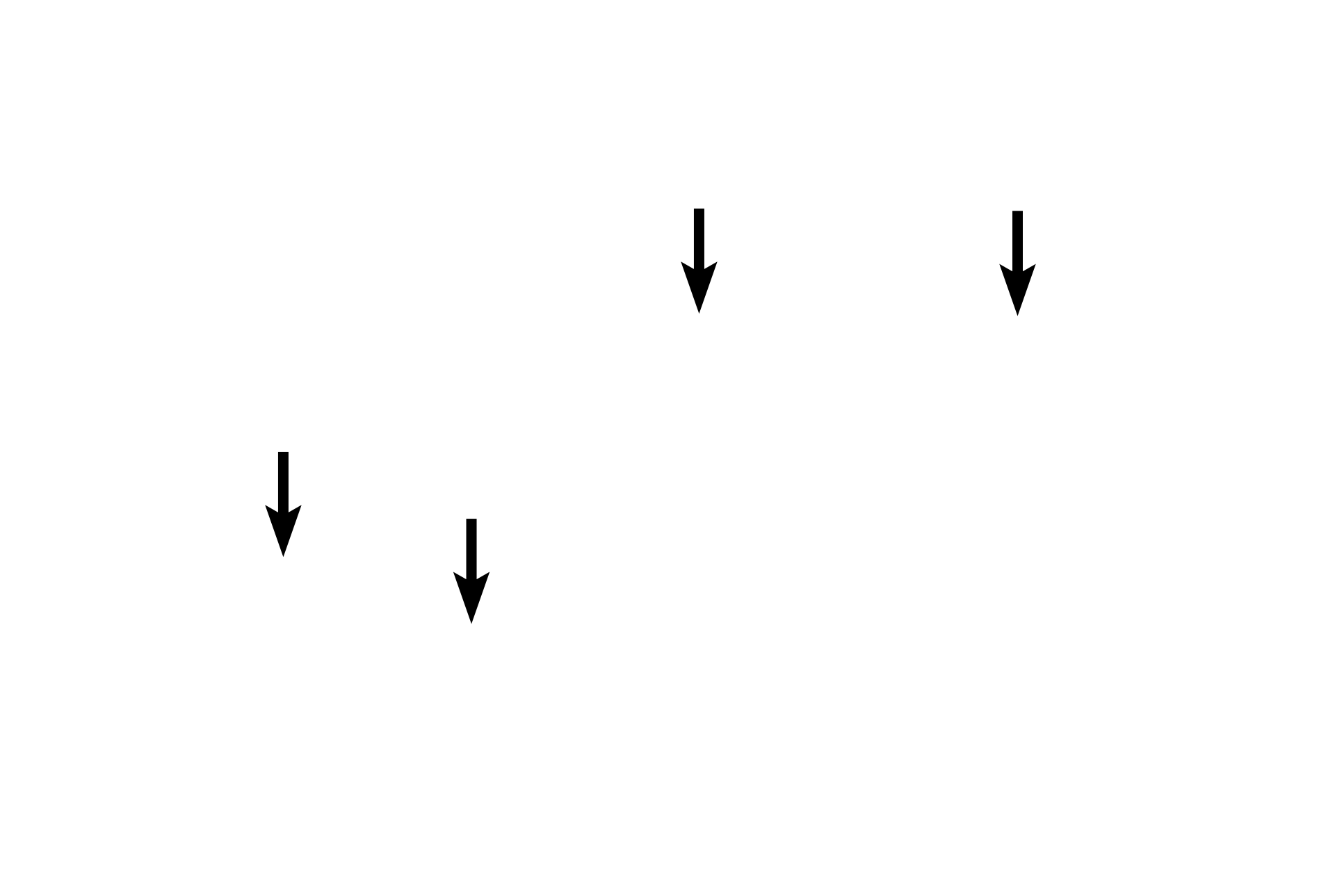 Endomysium <p>This H&E section shows muscle fibers cut in cross section and clearly demonstrates the myofibrils that fill the muscle fibers. Numerous capillaries are also visible. This is a section of the tongue which contains interlacing skeletal muscle fascicles and thus at the top and bottom of the image are fibers cut longitudinally. 800x</p>
