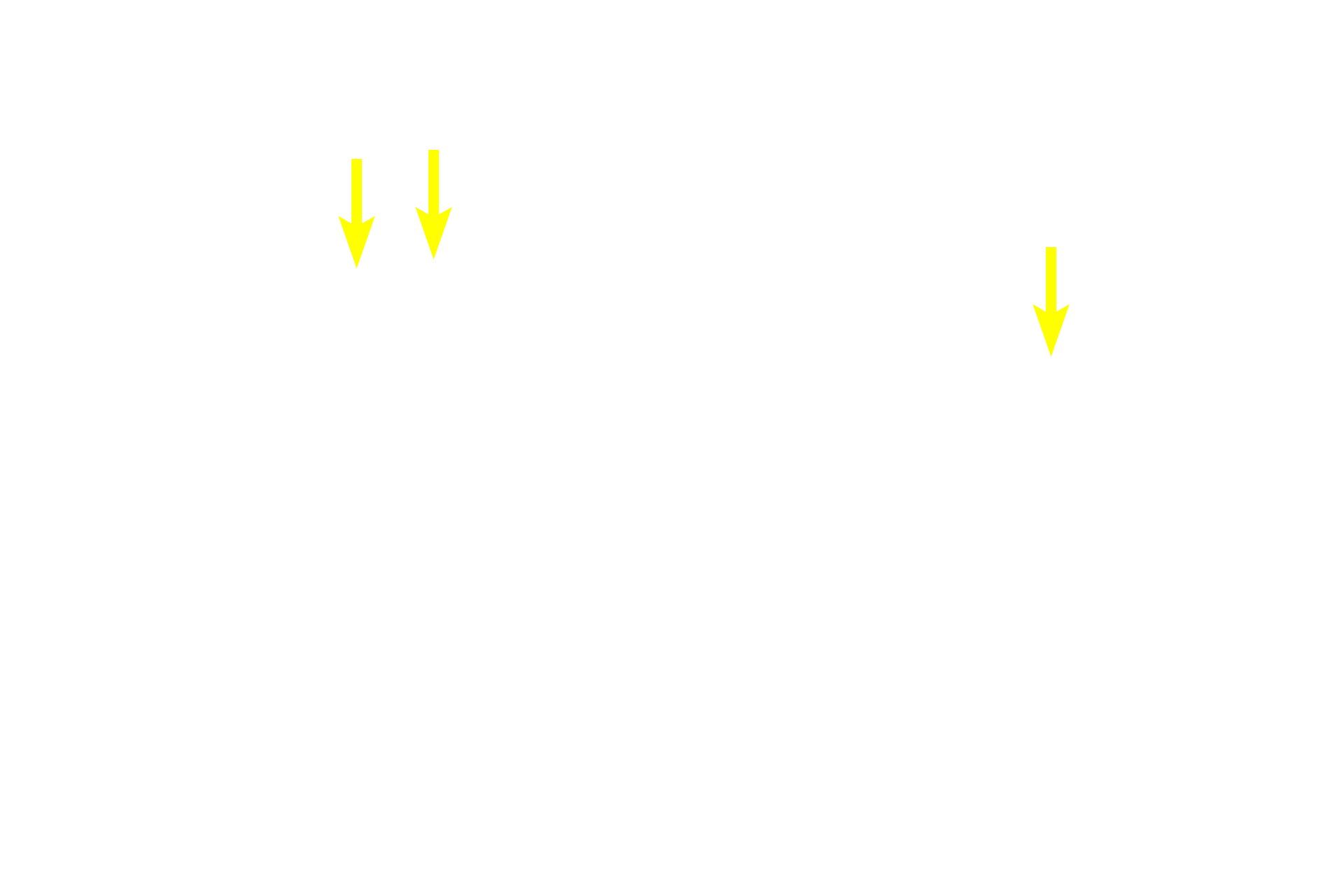 Isogenous groups <p>Chondrocytes in elastic cartilage are larger and more numerous than in hyaline cartilage and form fewer isogenous groups. The extracellular matrix of elastic cartilage is less abundant than in hyaline cartilage. This special stain demonstrates the abundant elastic fibers in the matrix.  Masson stain 100x</p>
