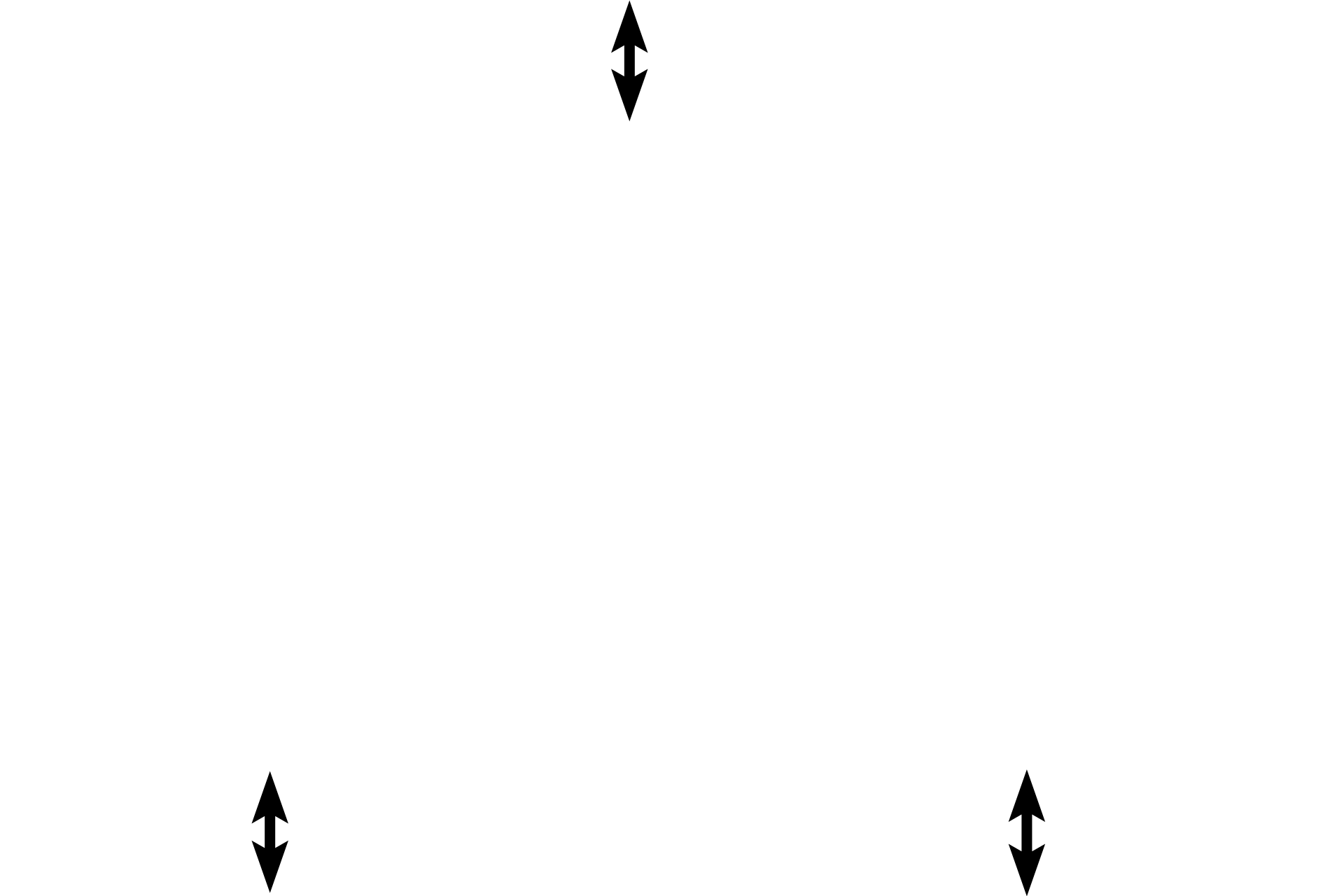 Perichondrium: fibrous layer <p>Elastic cartilage from the pinna of the ear is stained with a dye specific for elastin. The abundant elastic fibers and additional elastic material in the central regions of the cartilage obscure individual fibers.  However, they can be readily seen on the edges. Note the numerous chondrocytes but infrequent isogenous groups. 200x</p>
