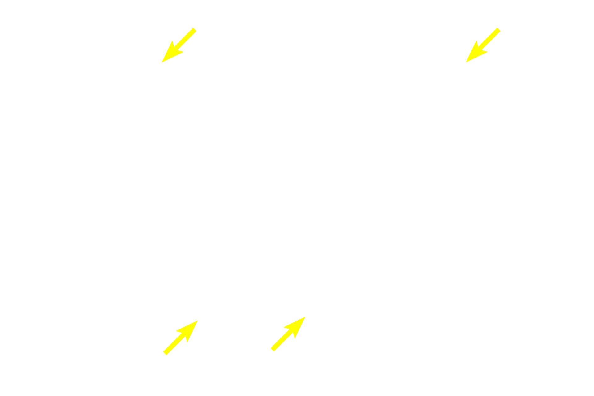 Chondroblasts <p>Elastic cartilage from the pinna of the ear is stained with a dye specific for elastin. The abundant elastic fibers and additional elastic material in the central regions of the cartilage obscure individual fibers.  However, they can be readily seen on the edges. Note the numerous chondrocytes but infrequent isogenous groups. 200x</p>
