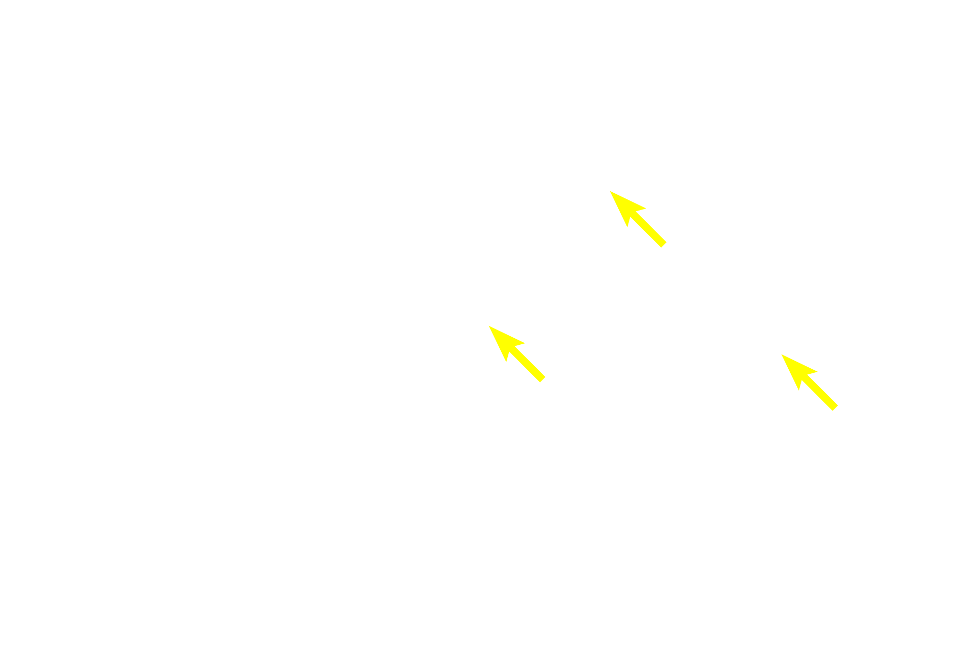 Chondrocytes <p>Elastic cartilage from the pinna of the ear is stained with a dye specific for elastin. The abundant elastic fibers and additional elastic material in the central regions of the cartilage obscure individual fibers.  However, they can be readily seen on the edges. Note the numerous chondrocytes but infrequent isogenous groups. 200x</p>
