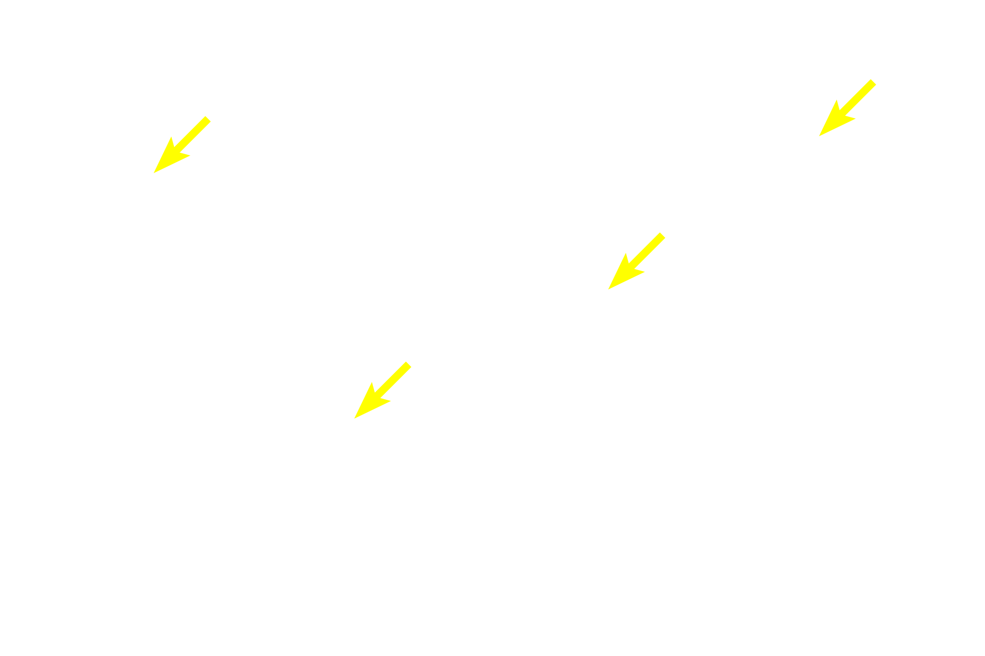 Elastic fibers <p>Elastic cartilage from the pinna of the ear is stained with a dye specific for elastin. The abundant elastic fibers and additional elastic material in the central regions of the cartilage obscure individual fibers.  However, they can be readily seen on the edges. Note the numerous chondrocytes but infrequent isogenous groups. 200x</p>
