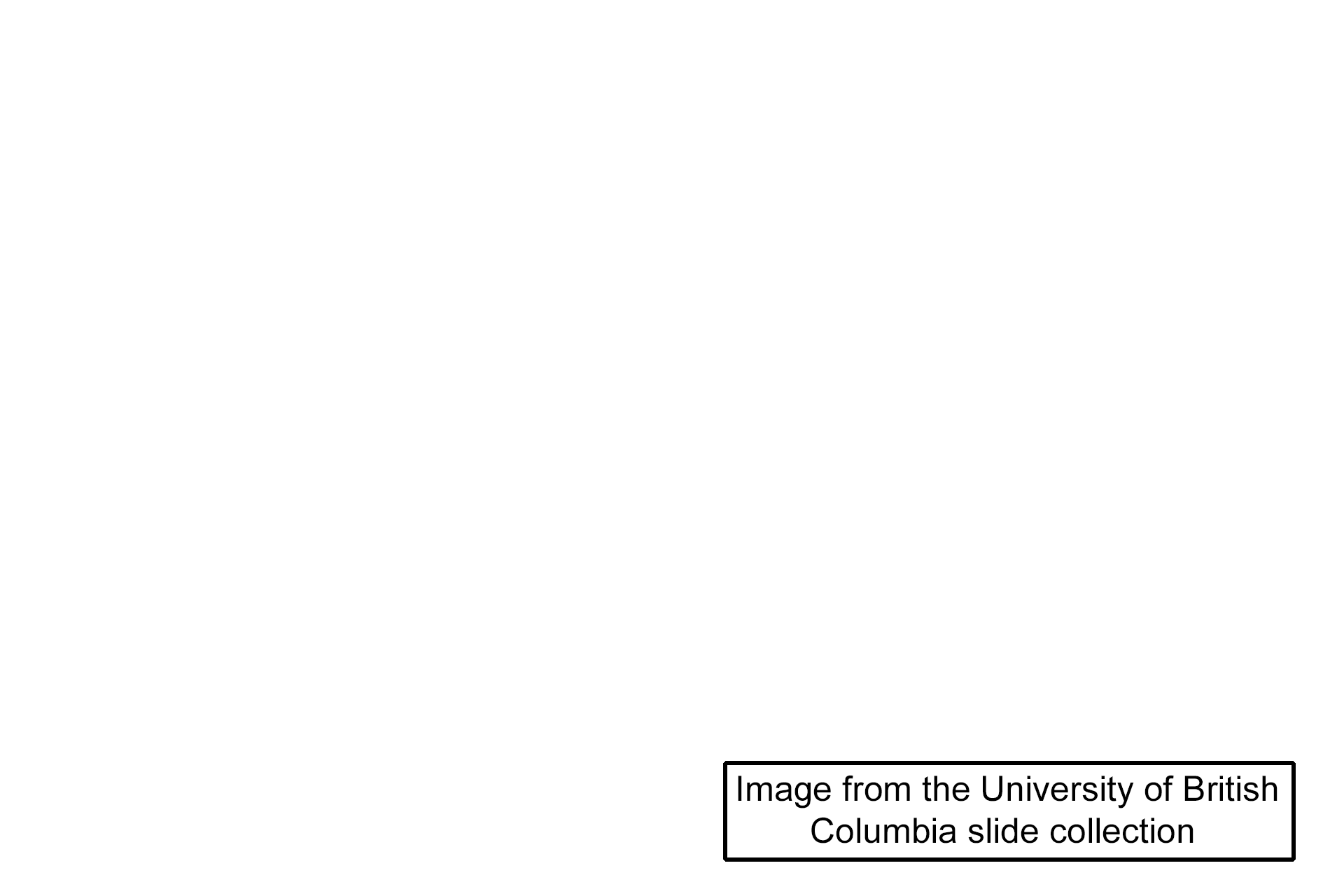 Image source > <p>Image from the University of British Columbia slide collection.</p>
