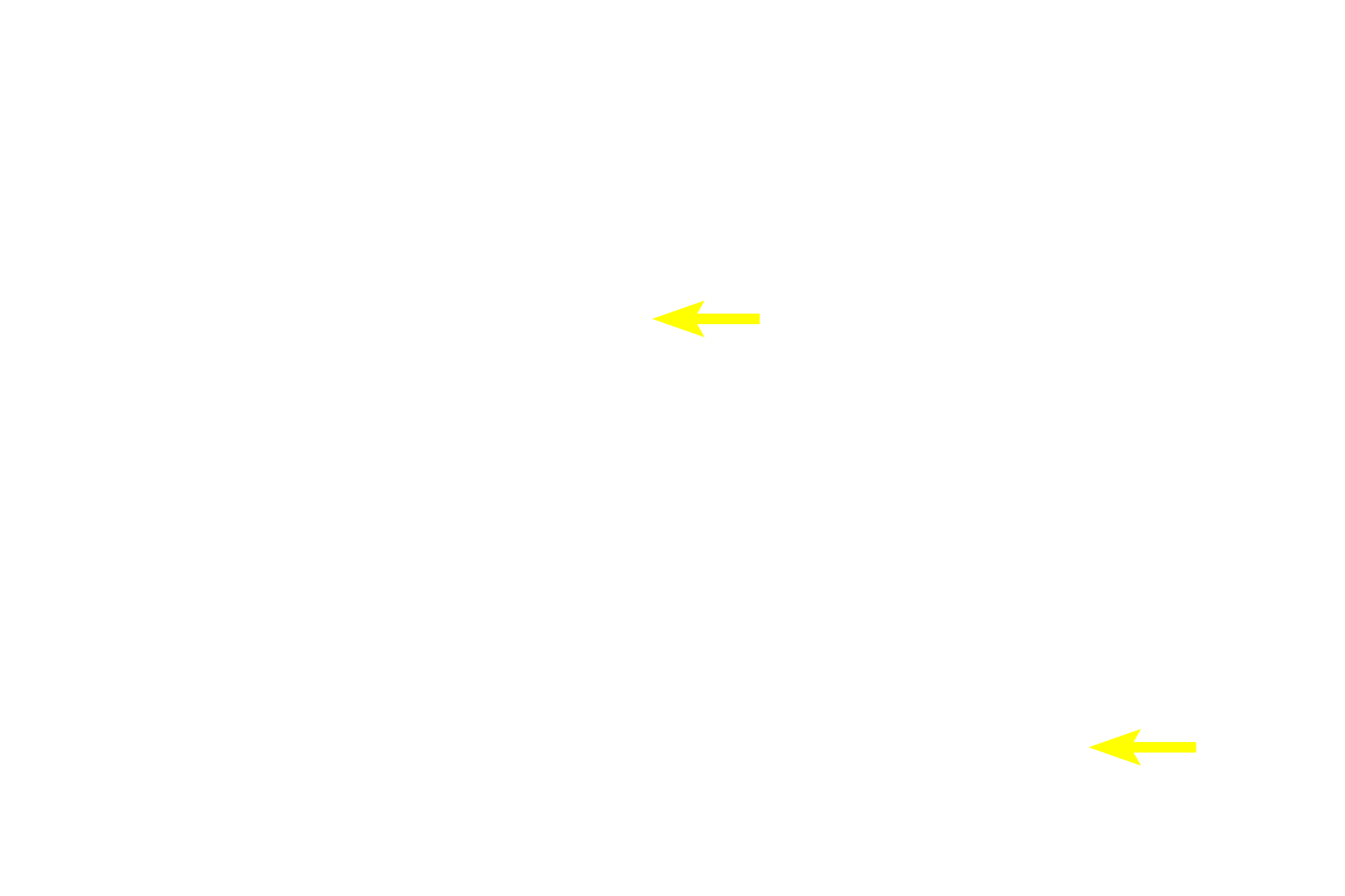 Tunica adventitia <p>Several characteristics differentiate arteries from their accompanying veins. Proportionally, arteries have narrower lumens and thicker walls than do veins. Veins are usually larger in diameter with wider lumens than their accompanying arteries. The tunica media is the predominant layer in arteries while the tunica adventitia generally is the thickest layer in veins.</p>
