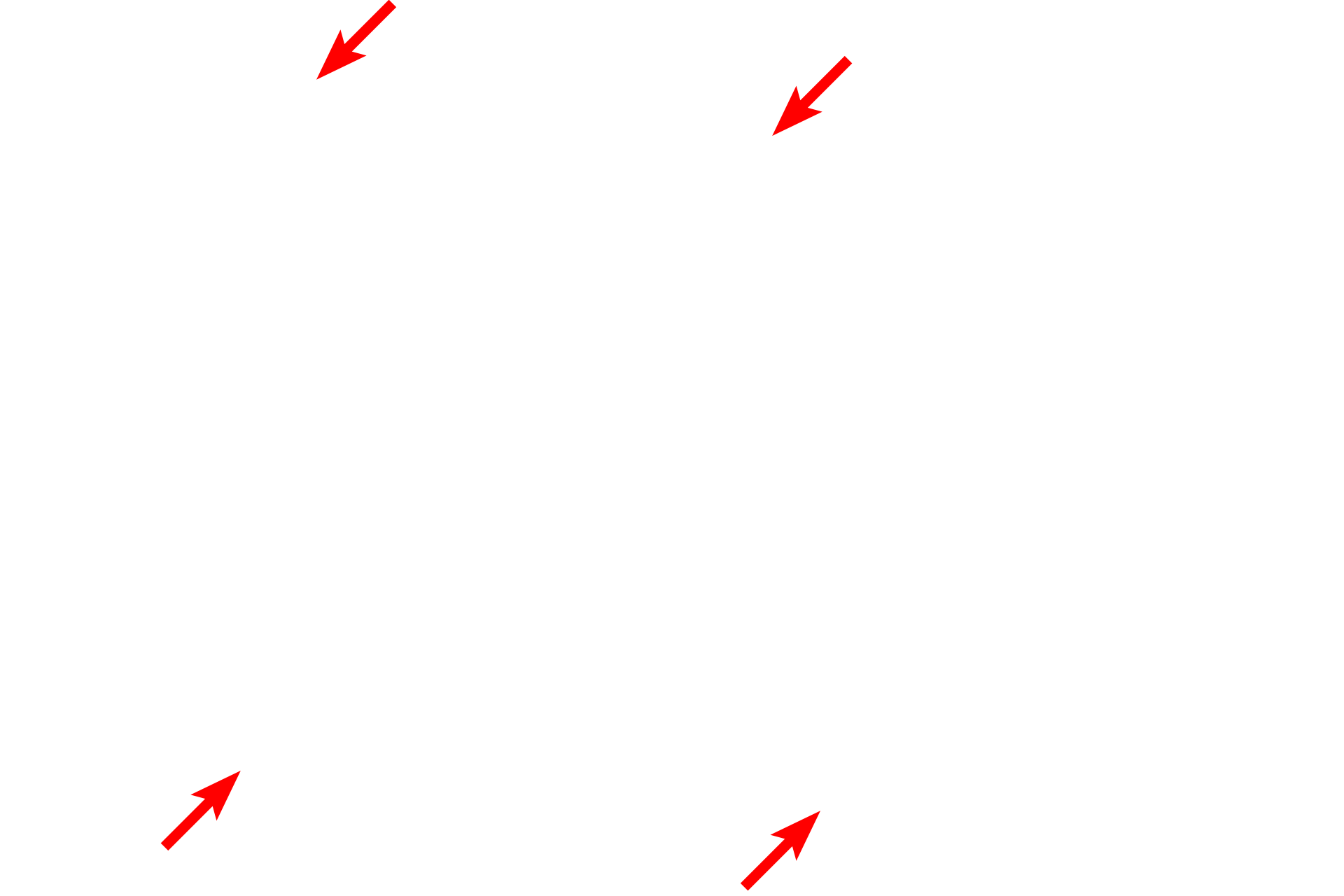 Sarcolemma <p>This electron micrograph shows an intercalated disc attaching two adjacent cardiac muscle fibers. It is formed by the interdigitating membranes of the fibers. The junction consists of an adherent cell junction called a fascia adherens, which is similar to the zonula adherens in epithelial cells. Additionally, there are gap junctions that allow for ionic continuity between fibers, permitting waves of contraction to spread across the myocardium. The electron density is produced by the junctional proteins along with additional associated proteins. 5000x</p>
