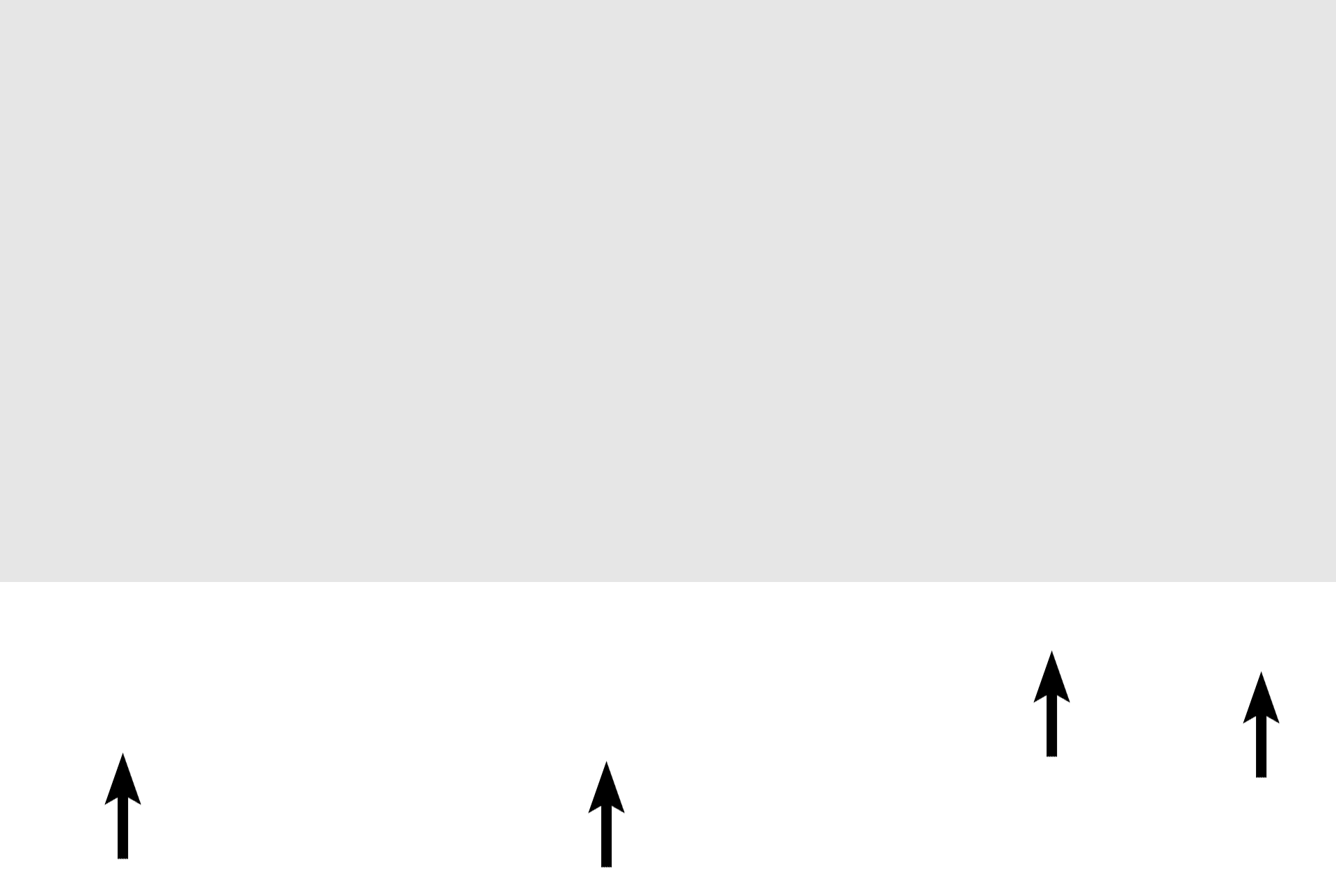  - Nuclei <p>Smooth muscle fibers are spindle shaped, i.e., they taper toward their ends. They have a single, centrally located nucleus and are non-striated. Myofilaments are not organized into myofibrils and, thus, no banding pattern is present. Smooth muscle fibers are the smallest fiber type and form much of the wall of hollow organs and blood vessels. Smooth muscle is classified as involuntary, non-striated muscle.</p>
