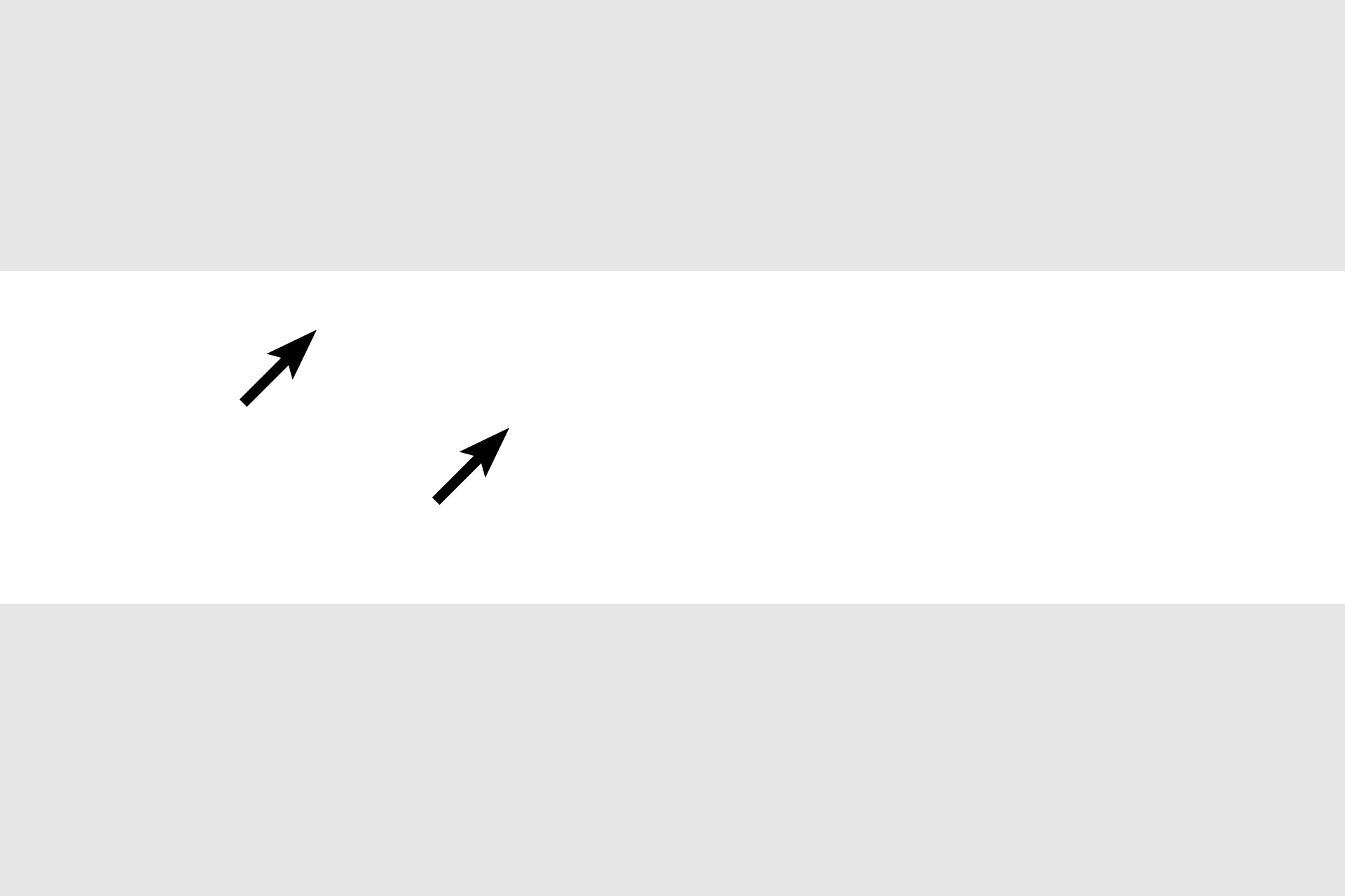  - Striations <p>Cardiac muscle fibers are also cylindrical, however, they branch. They have a single, centrally located nucleus and, like skeletal muscle fibers, are striated, but the bands are less prominent.  Cardiac muscle is mostly restricted to the wall of the heart and is classified as involuntary, striated muscle.</p>
