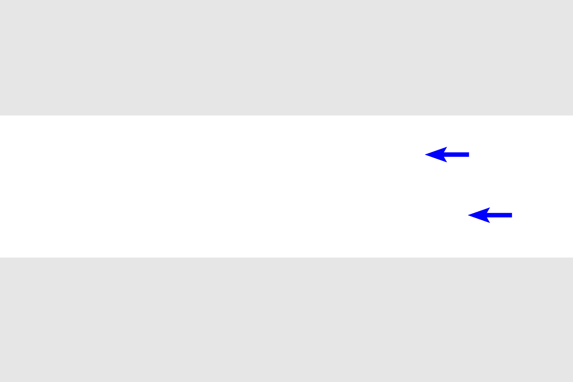 - Myofibrils <p>Cardiac muscle fibers are also cylindrical, however, they branch. They have a single, centrally located nucleus and, like skeletal muscle fibers, are striated, but the bands are less prominent.  Cardiac muscle is mostly restricted to the wall of the heart and is classified as involuntary, striated muscle.</p>
