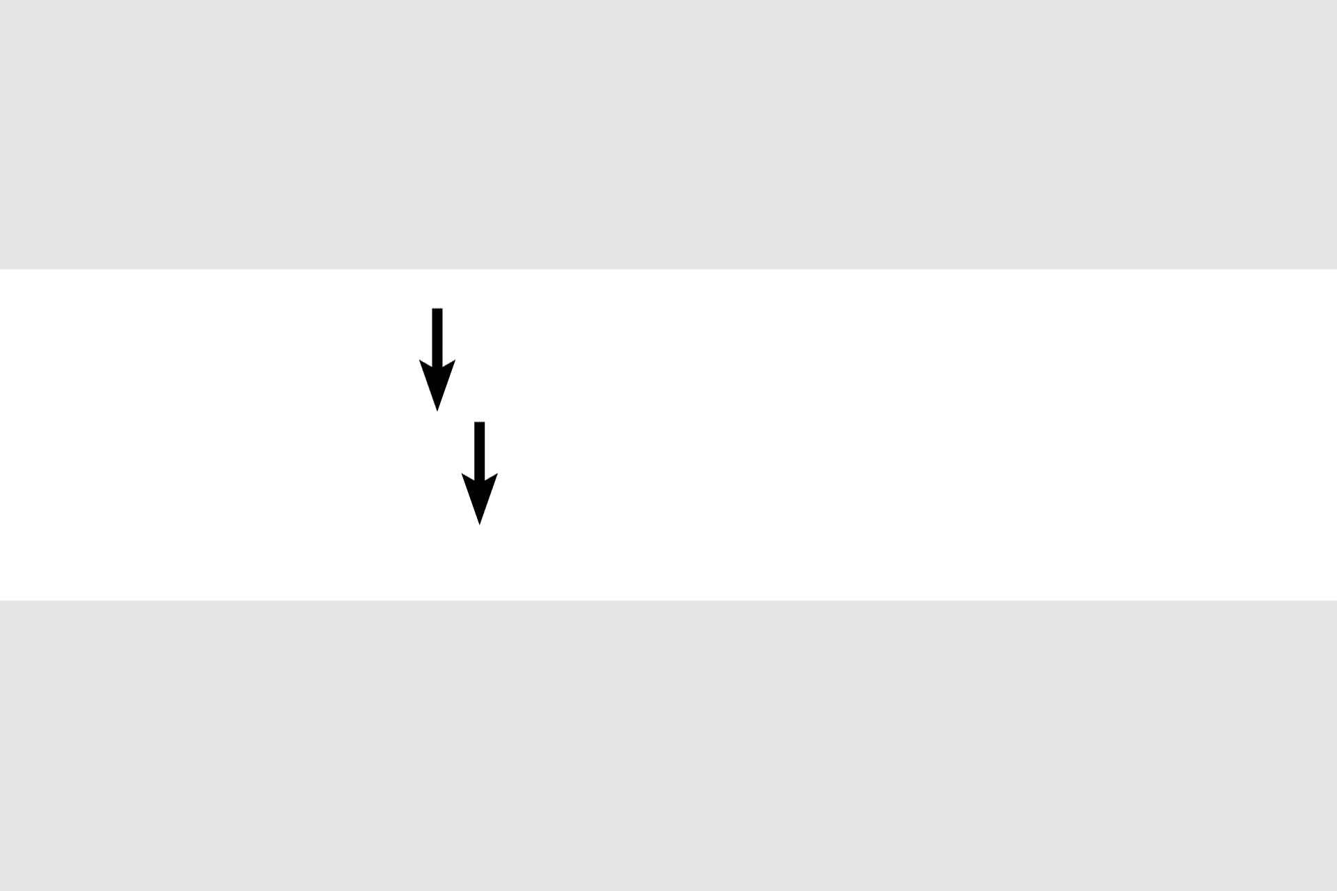  - Branching fibers > <p>Individual cardiac muscle fibers branch, allowing them to form a dense feltwork that makes up the myocardium of the heart.</p>
