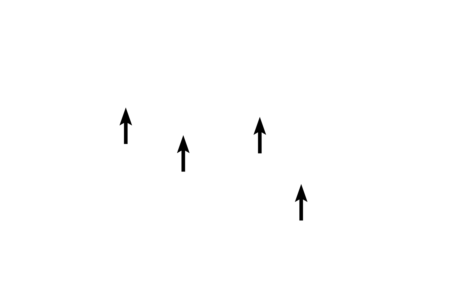  - Z lines <p>The light I band contains thin filaments only and is bisected by the Z line.</p>
