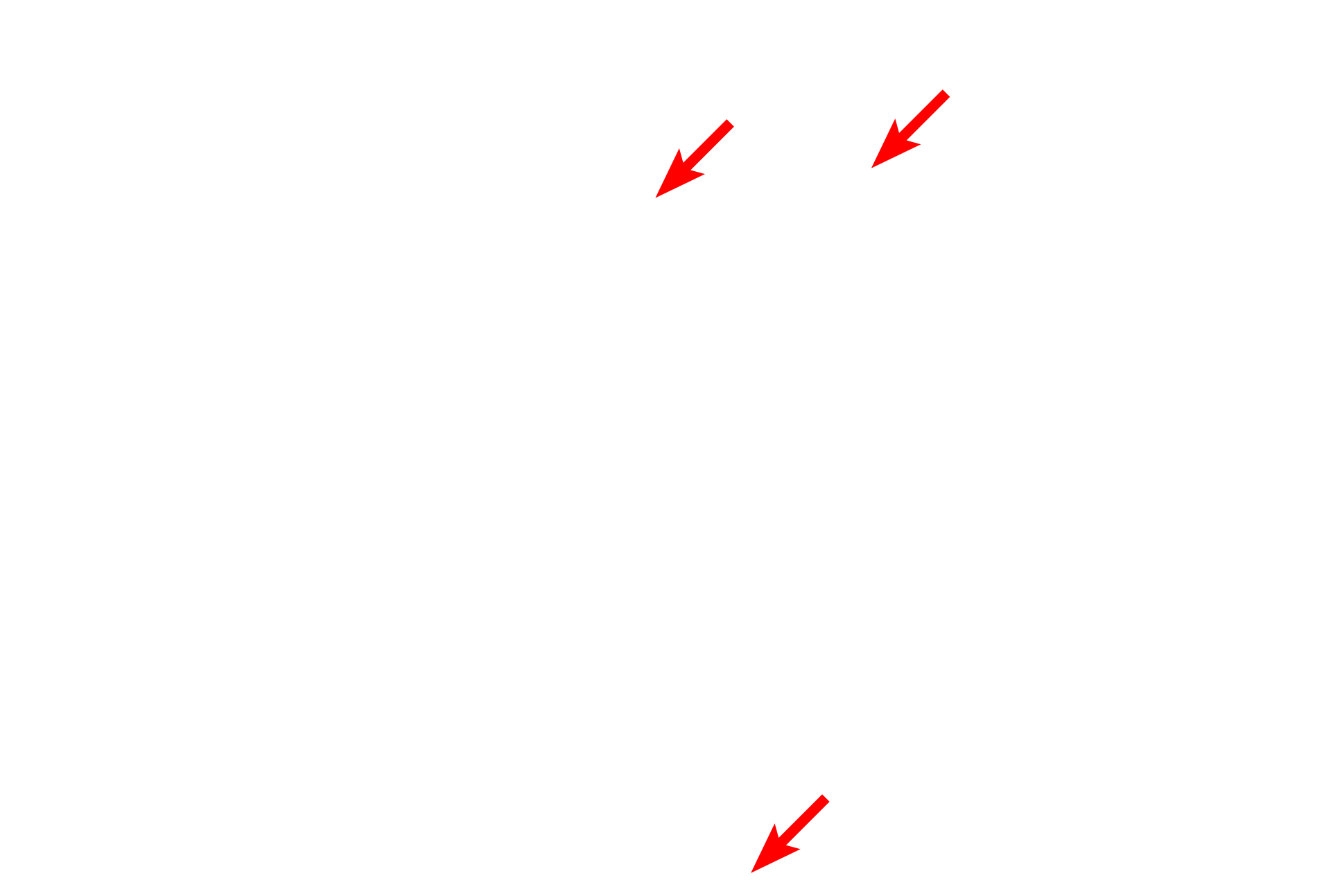 Sarcoplasmic reticulum (SER) <p>The banding pattern seen in the high magnification light micrograph (left) is compared with that seen by electron microscopy (right). The bands in all the individual myofibrils are closely aligned, resulting in the overall banding pattern seen by light microscopy. Sparse cytoplasm (sarcoplasm) between the myofibrils contains mitochondria, sarcoplasmic reticulum and glycogen. 1,000x, 15,000x</p>
