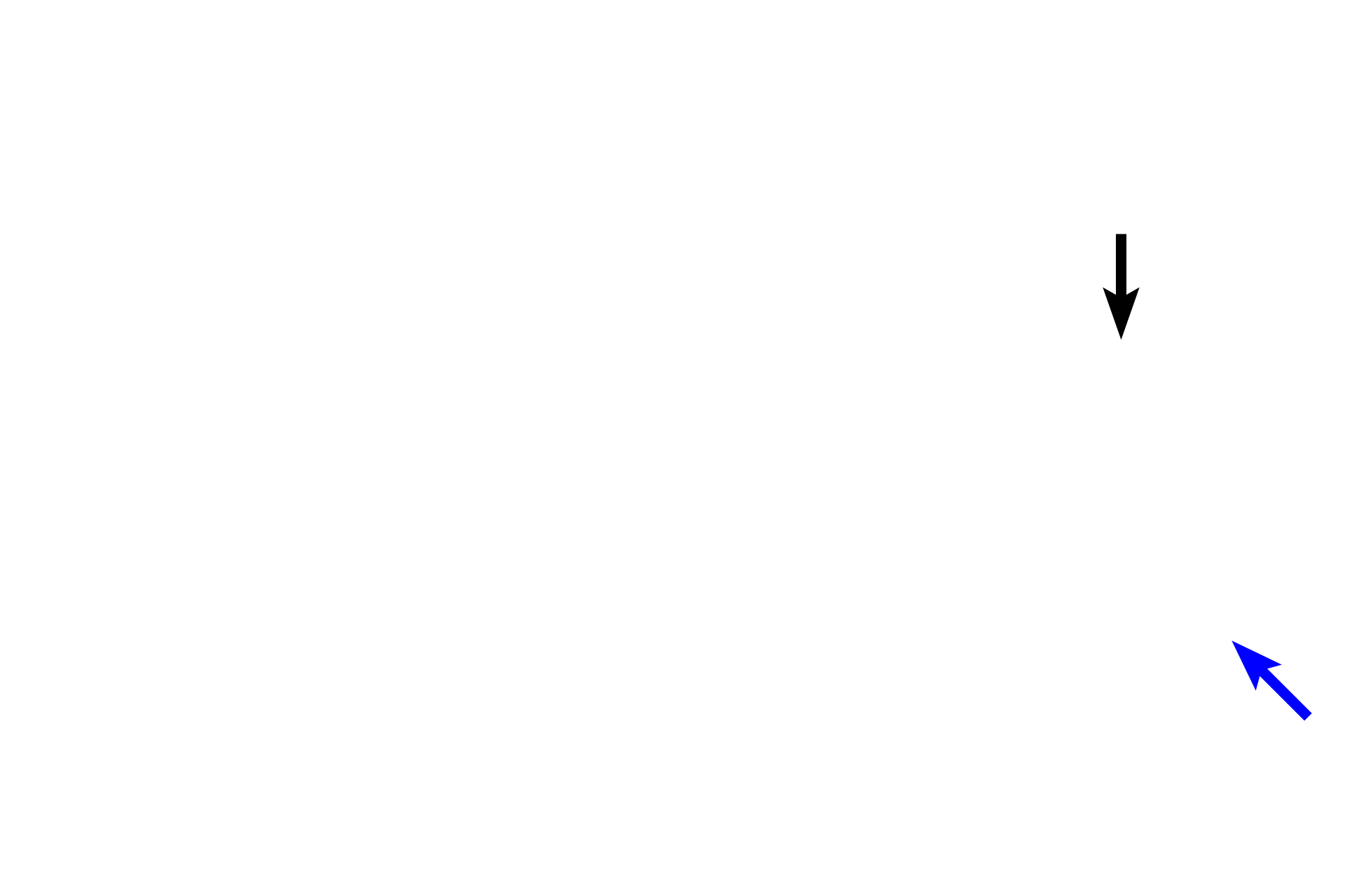 Ascending thick limb > <p>The ascending thick limb (black arrow) associated with this renal corpuscle loops back to its own vascular pole, where it lies adjacent to the afferent arteriole. Modified cells in the wall of the tubule, the macula densa, and cells in the wall of the afferent arteriole, juxtaglomerular cells, comprise the juxtaglomerular apparatus, which regulates blood pressure and blood volume.  The tubule continues as the distal convoluted tubule (blue arrow).</p>
