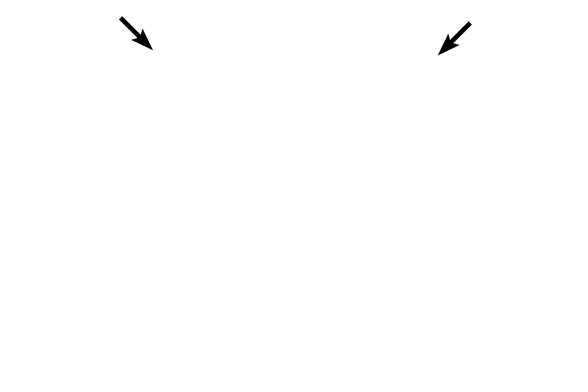 Dorsal roots <p>A cross section of human lumbar spinal cord has been stained to show areas of white matter (myelinated axons) and grey matter (neuronal cell bodies).  The grey matter is subdivided into dorsal and ventral horns.  The cell bodies of multipolar neurons are located in the ventral horn.  Small segments of dorsal and ventral roots are also present, though their attachment to cord is not visible.  20x</p>
