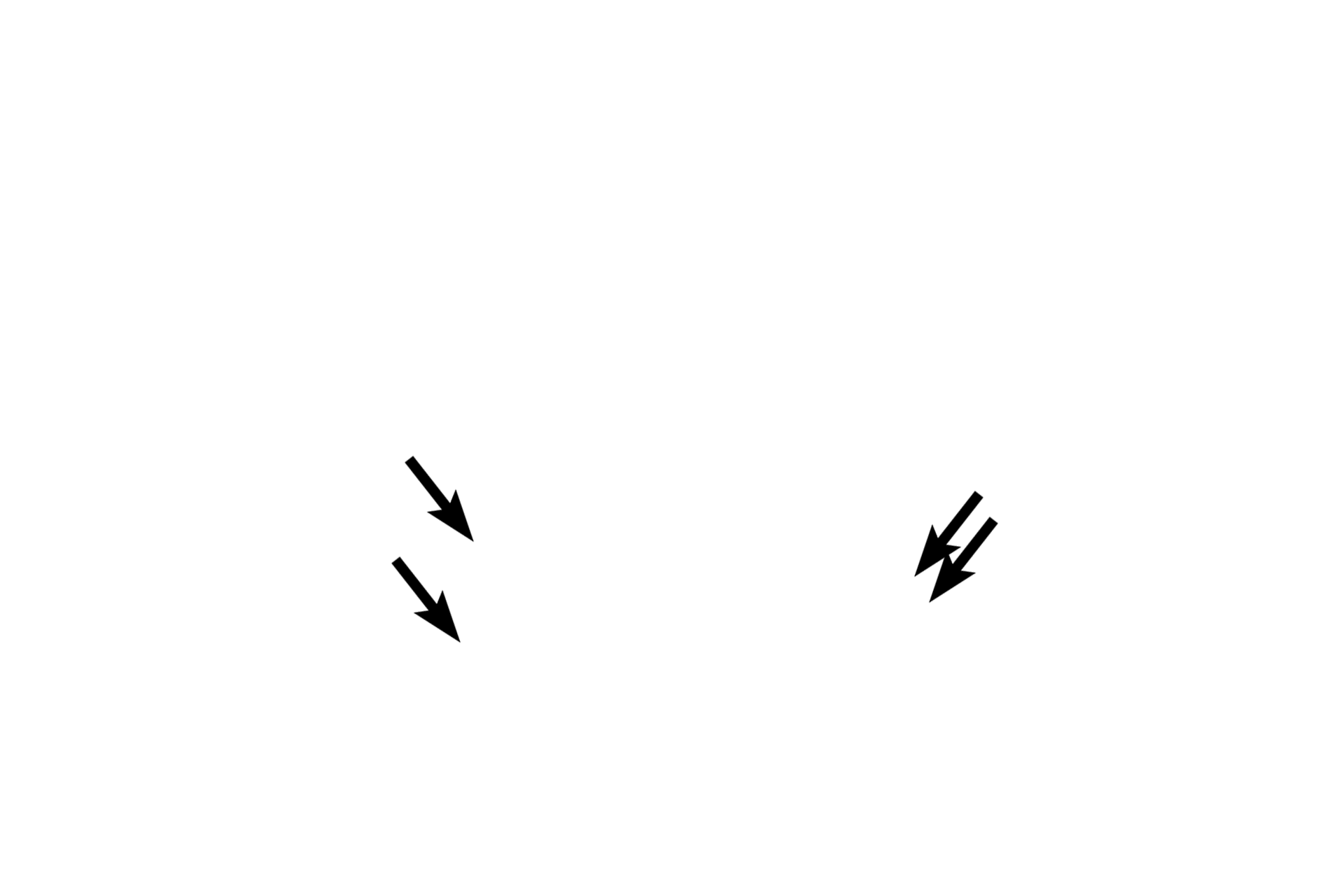 Cell bodies <p>A cross section of human lumbar spinal cord has been stained to show areas of white matter (myelinated axons) and grey matter (neuronal cell bodies).  The grey matter is subdivided into dorsal and ventral horns.  The cell bodies of multipolar neurons are located in the ventral horn.  Small segments of dorsal and ventral roots are also present, though their attachment to cord is not visible.  20x</p>
