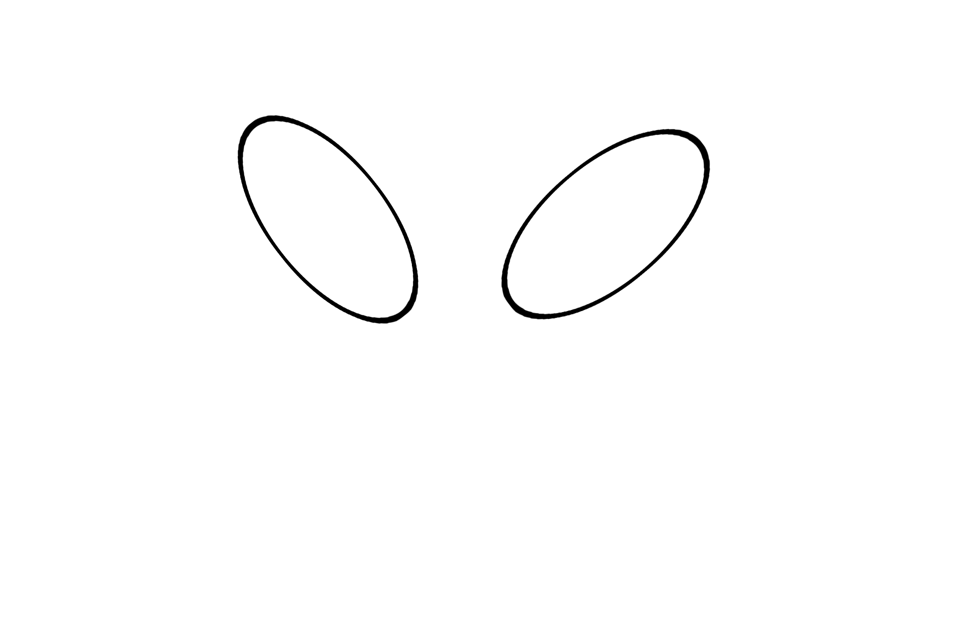 Dorsal horns <p>A cross section of human lumbar spinal cord has been stained to show areas of white matter (myelinated axons) and grey matter (neuronal cell bodies).  The grey matter is subdivided into dorsal and ventral horns.  The cell bodies of multipolar neurons are located in the ventral horn.  Small segments of dorsal and ventral roots are also present, though their attachment to cord is not visible.  20x</p>
