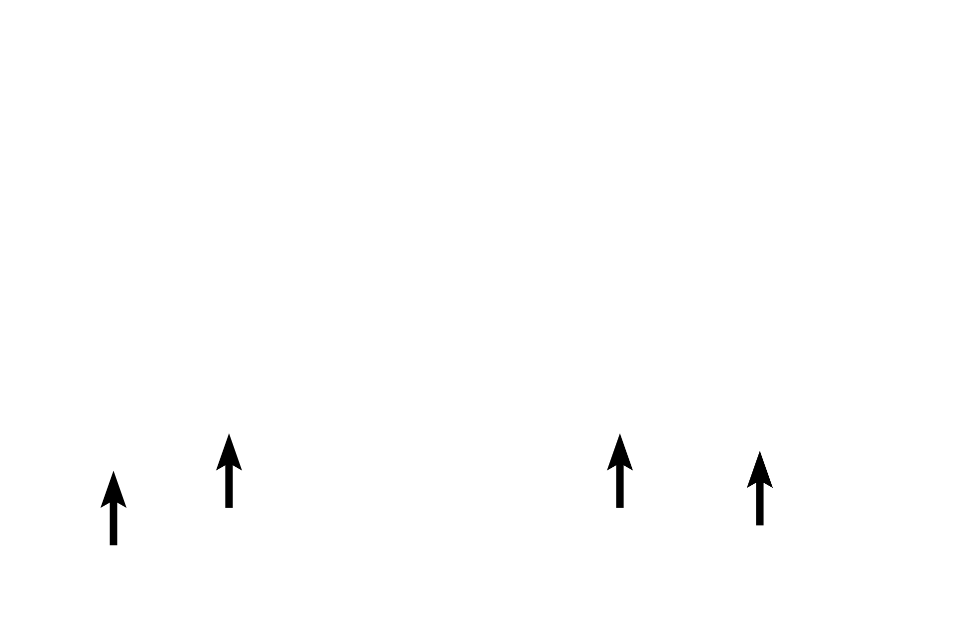 Ventral roots > <p>The ventral root contains motor axons from multipolar neurons whose cell bodies are located in the ventral horn of the grey matter.  Their axons pass in the spinal nerve to innervate muscle tissues in the periphery. </p>
