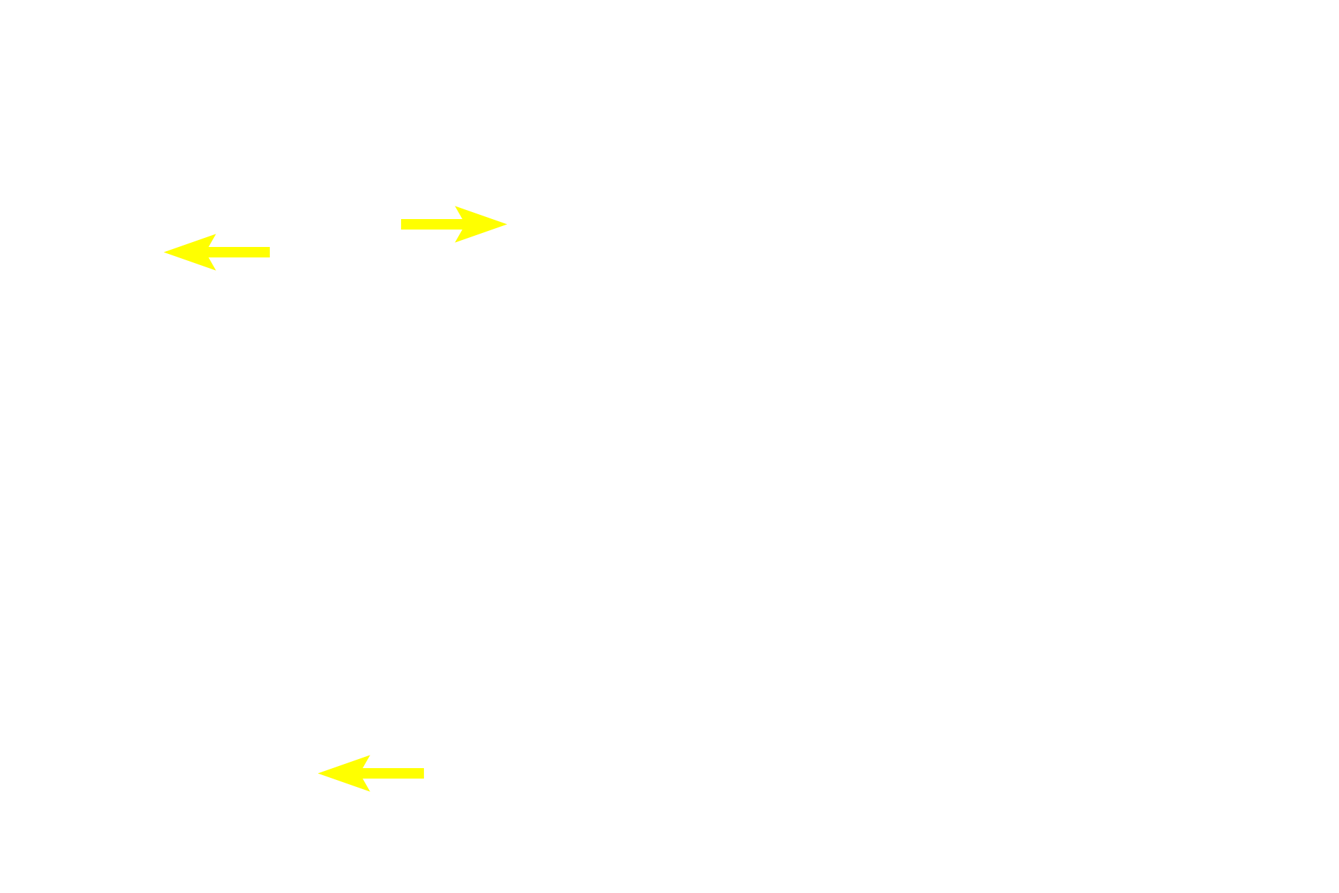 Axons <p>These multipolar neurons are located in an autonomic ganglion in the sympathetic division of the autonomic nervous system.  Sympathetic ganglia are generally located at some distance from the organs they innervate and contain large numbers of both incoming preganglionic axons as well as exiting, efferent postganglionic axons from the multipolar neurons.  The neuron cell bodies are widely dispersed and extend numerous dendrites.  Eccentrically-located nuclei are common.  Satellite Schwann cells surround each neuronal in the ganglion.  Their cytoplasmic processes form a capsule around the cell body. 100x, 1000x</p>
