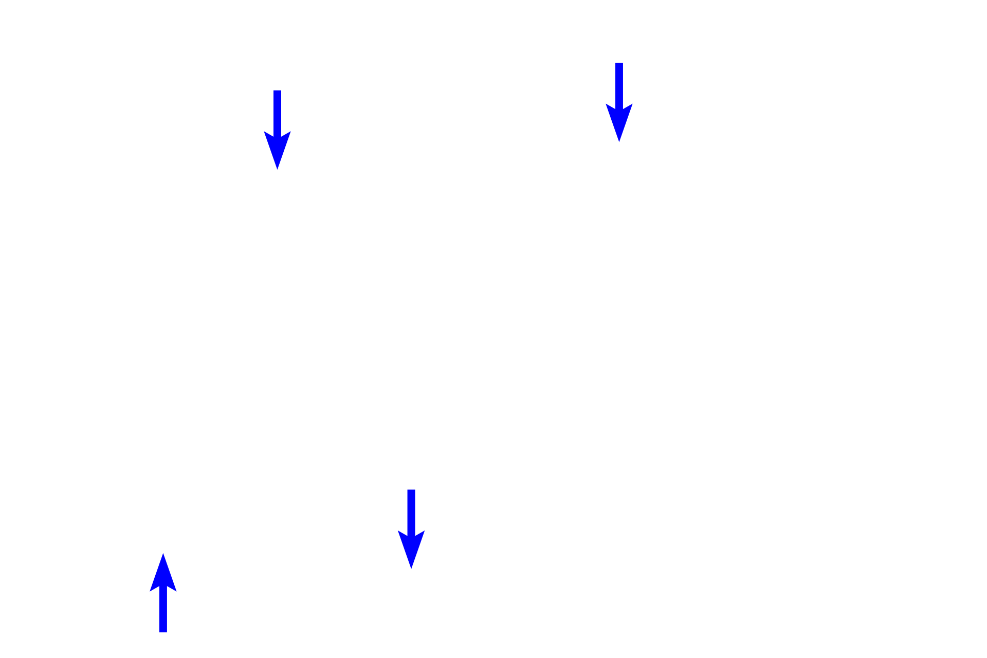 Axons <p>The unique shape of sensory, pseudounipolar neurons is demonstrated in this silver-stained section.  A single stem process emerges from the spherical cell body and eventually branches into central and peripheral axons.  This bifurcation is not visible here however the silver stain does reveal the twisted course of the stem process as it leaves the cell body.  This region is called the initial glomerulus of Cajal.  No dendrites originate from the cell body.  Silver stain, 600x</p>
