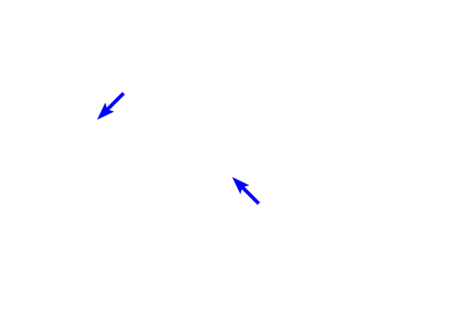 Stem process <p>Pseudounipolar neurons extend a single stem process that initially forms a twisted glomerulus-like structure.  Thereafter, it branches into central and peripheral processes, which are both functionally and structurally axonal.  This branching is not visible in this image.  Silver stain, 1000x</p>
