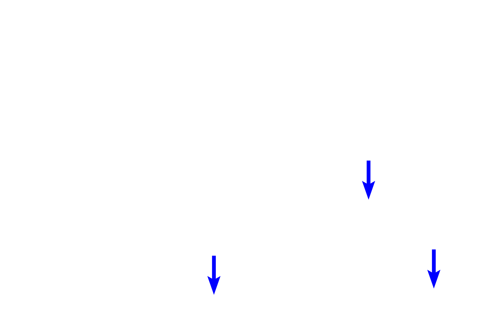 Axons <p>Pseudounipolar neurons extend a single stem process that initially forms a twisted glomerulus-like structure.  Thereafter, it branches into central and peripheral processes, which are both functionally and structurally axonal.  This branching is not visible in this image.  Silver stain, 1000x</p>
